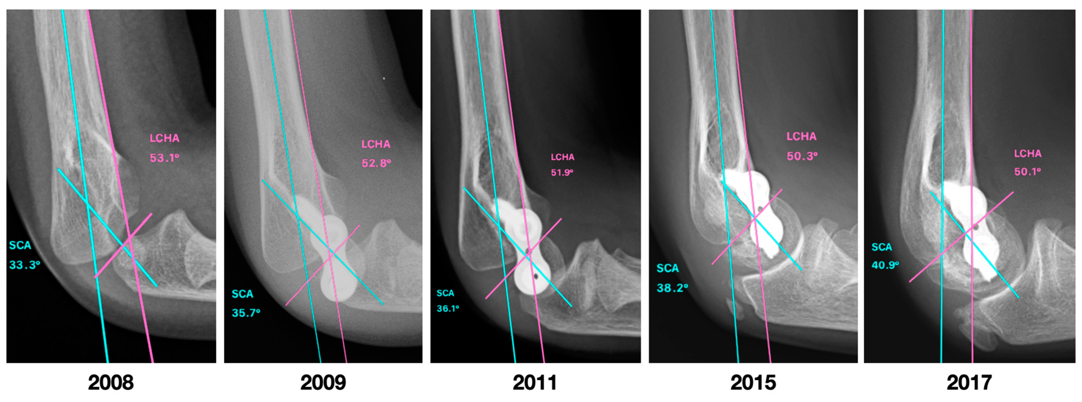 Jcm 12 02632 g007 Jcm 12 02632 g007