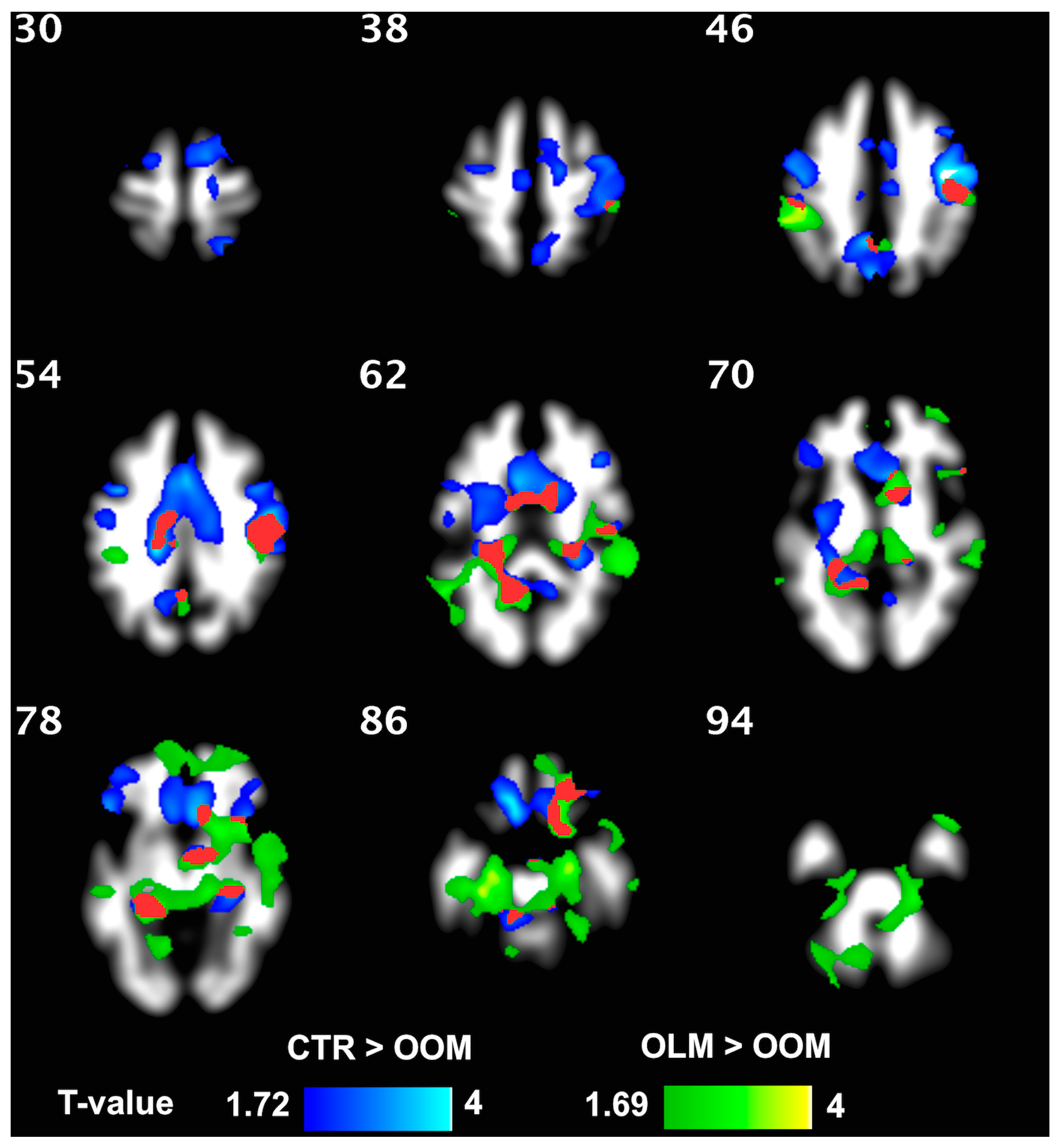 Jcm 12 02684 g002 Jcm 12 02684 g002