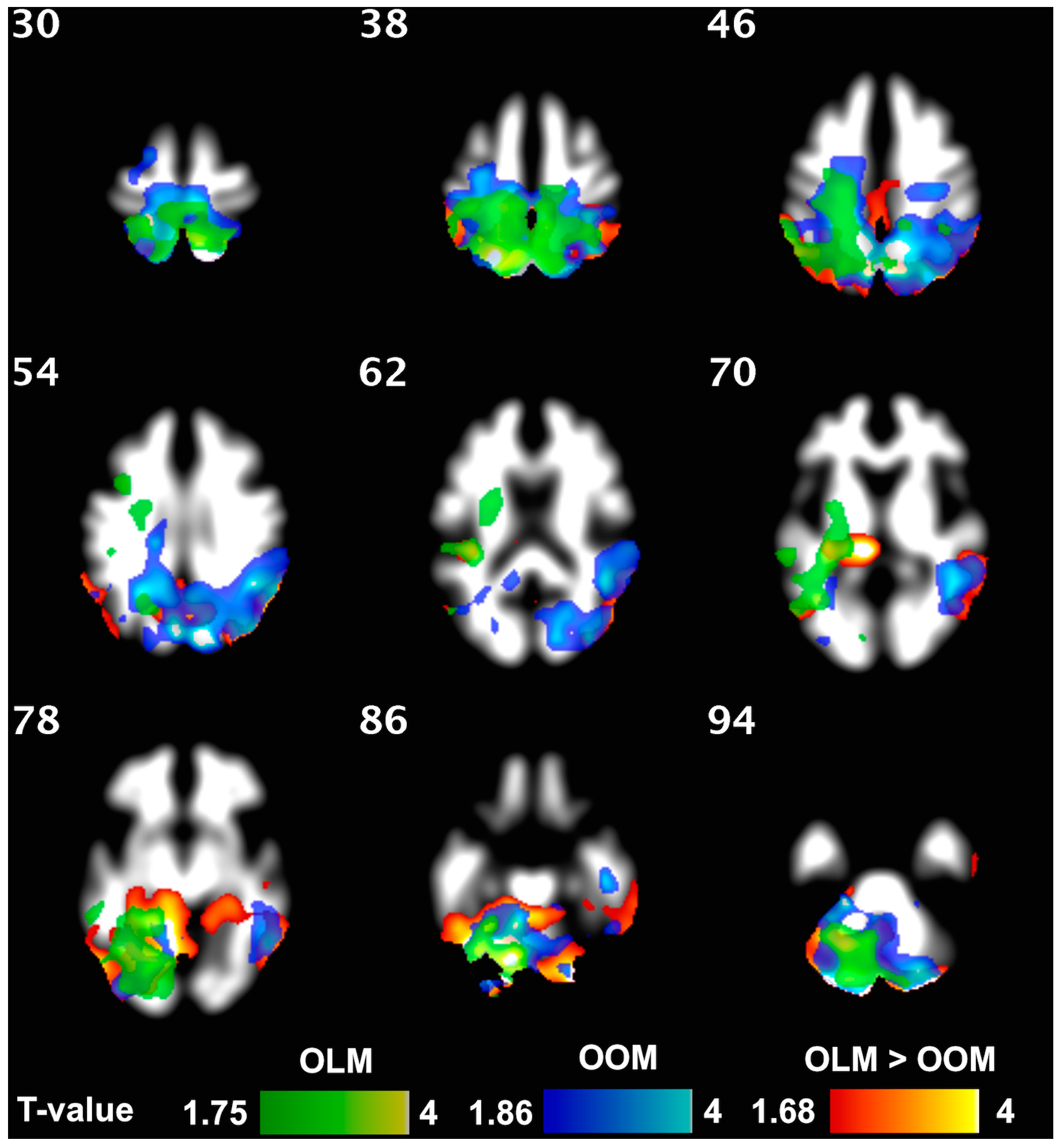 Jcm 12 02684 g003 Jcm 12 02684 g003