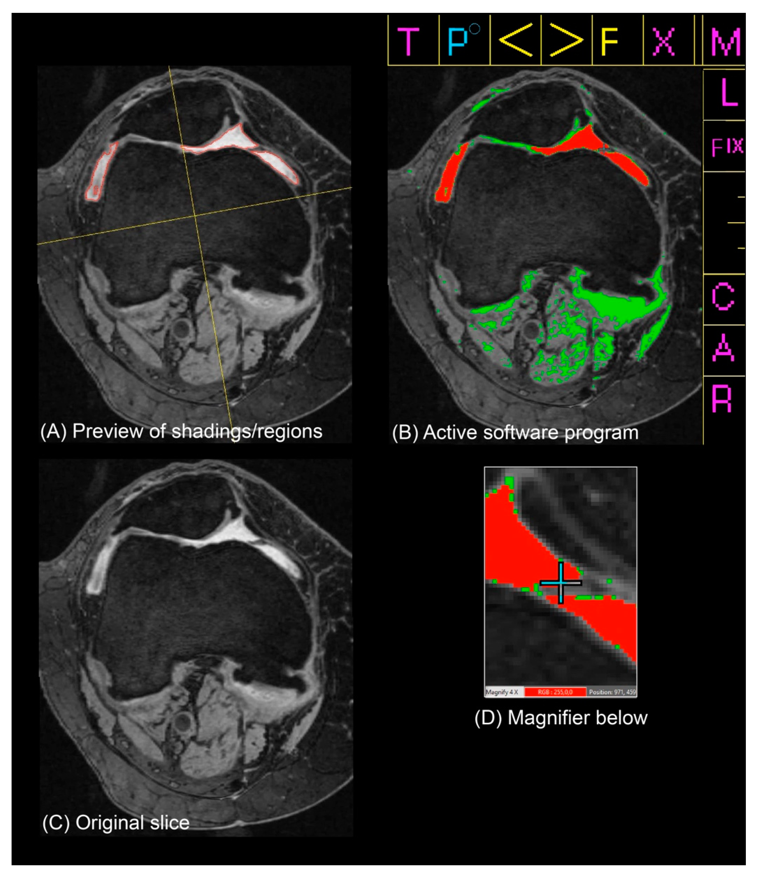 Jcm 12 02691 g002 Jcm 12 02691 g002