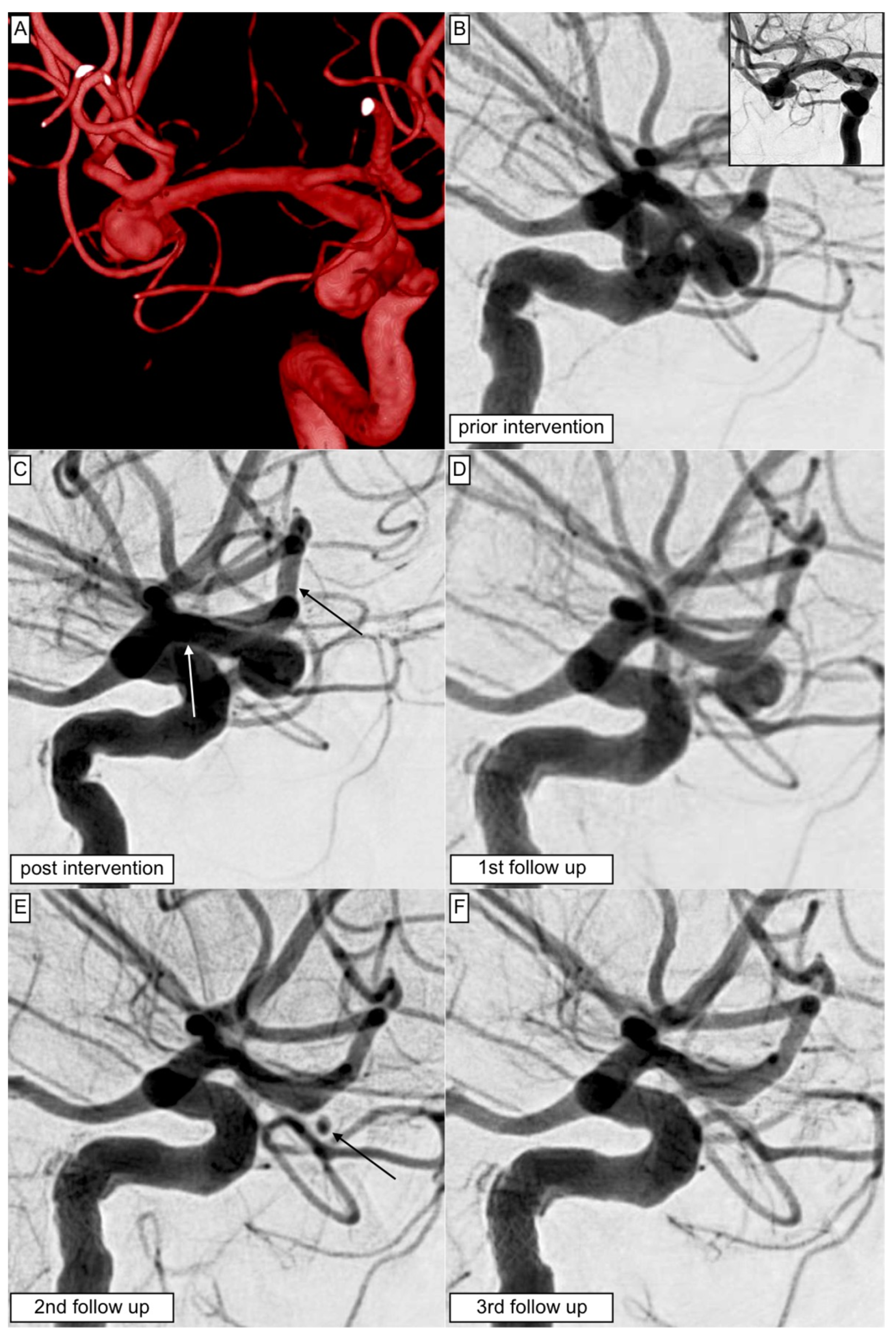 Jcm 12 02700 g002 Jcm 12 02700 g002