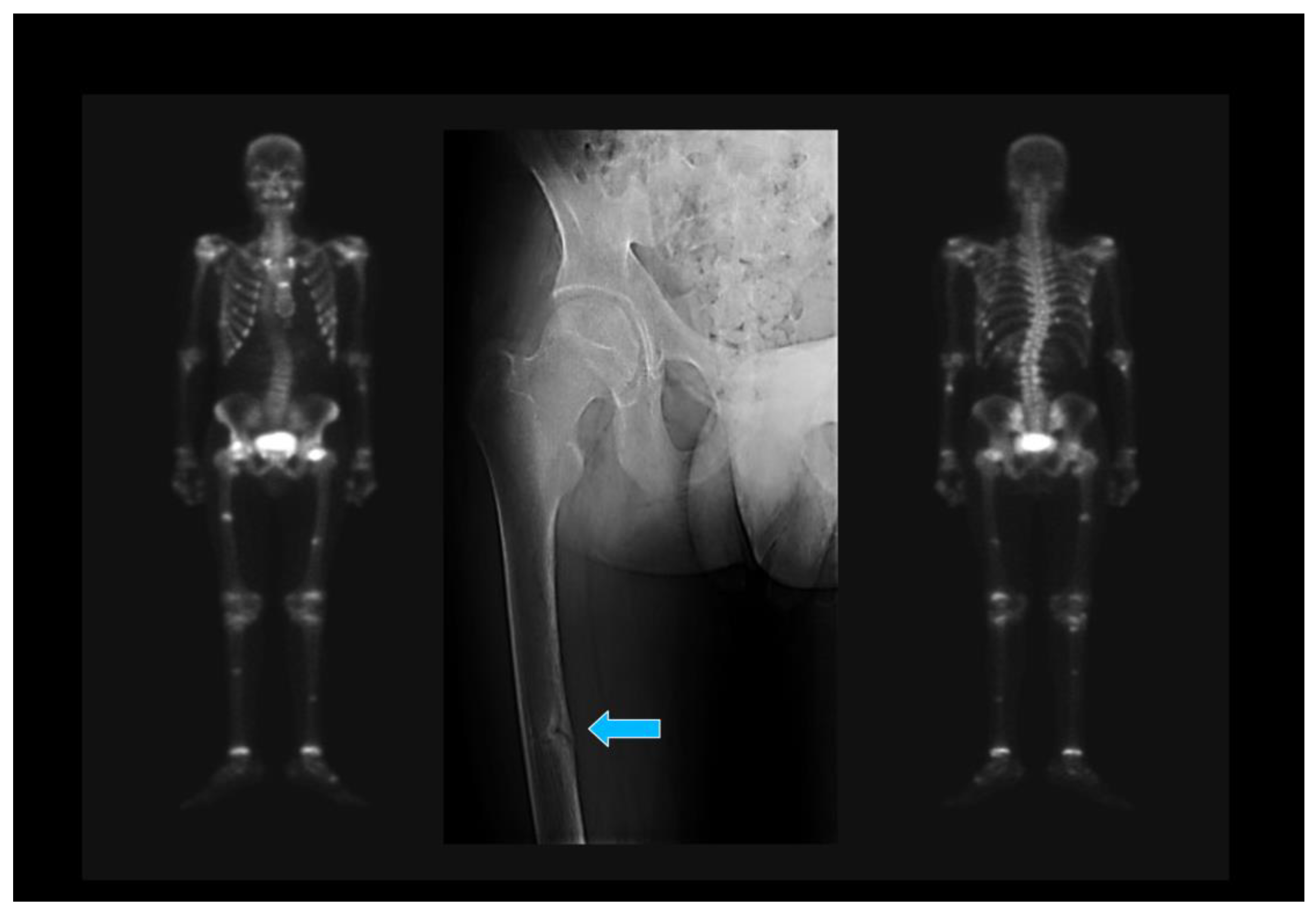 JCM | Free Full-Text | Osteomalacia in Adults: A Practical Insight for  Clinicians