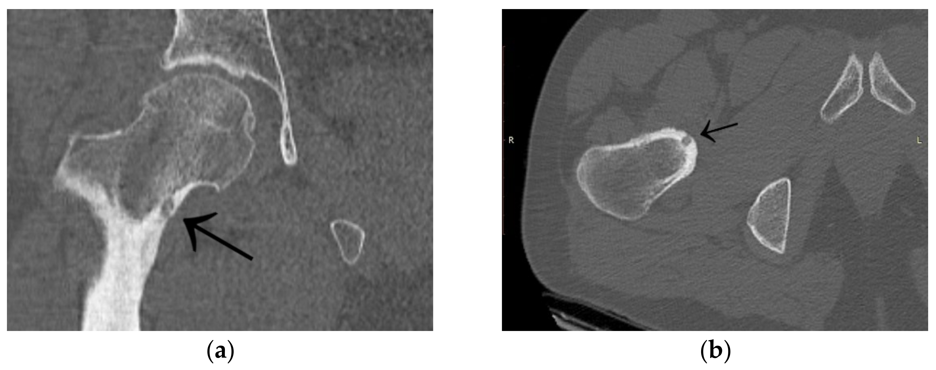 Jcm 12 02721 g002 Jcm 12 02721 g002