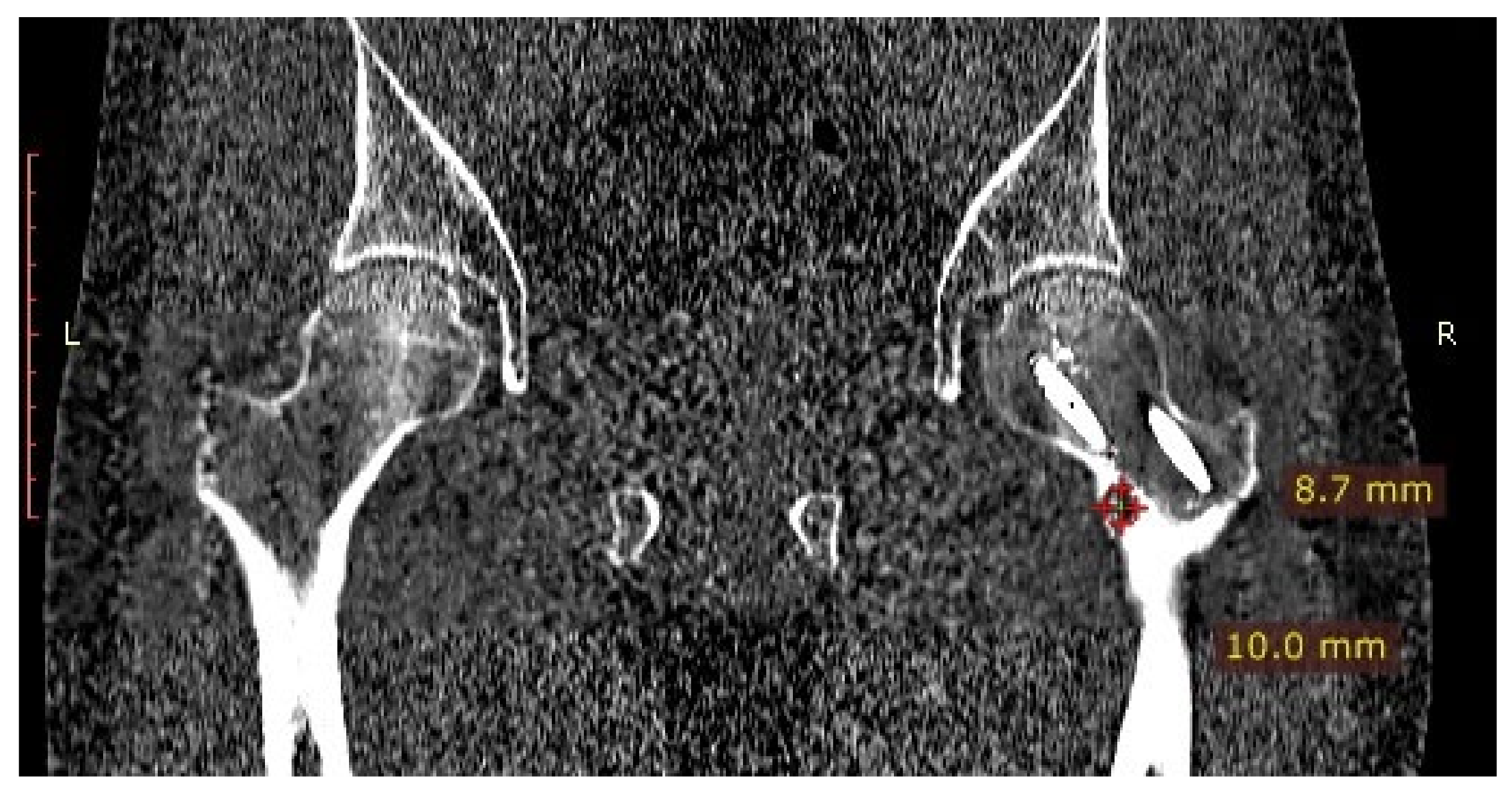 Jcm 12 02721 g010 Jcm 12 02721 g010