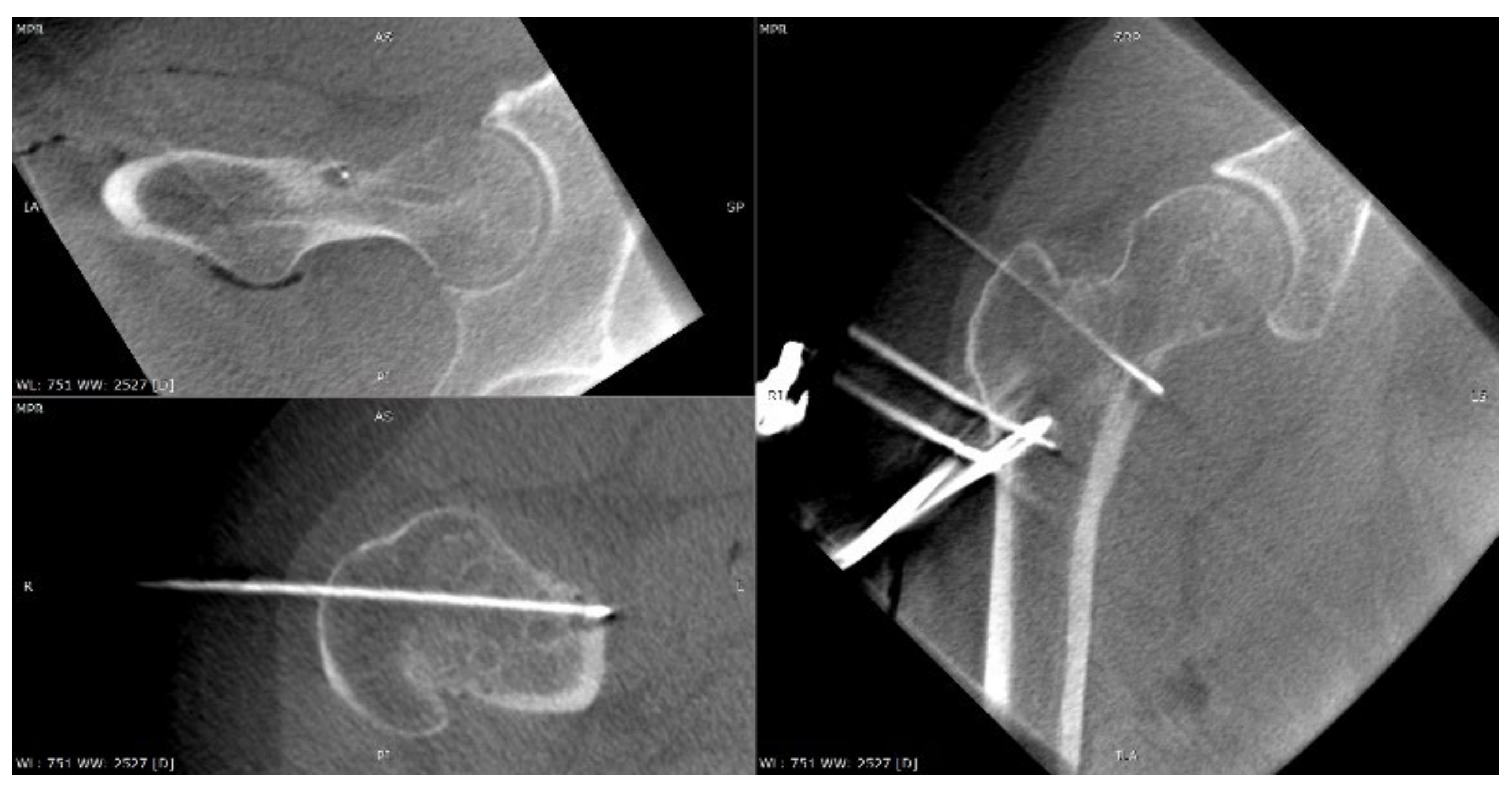 Jcm 12 02721 g011 Jcm 12 02721 g011