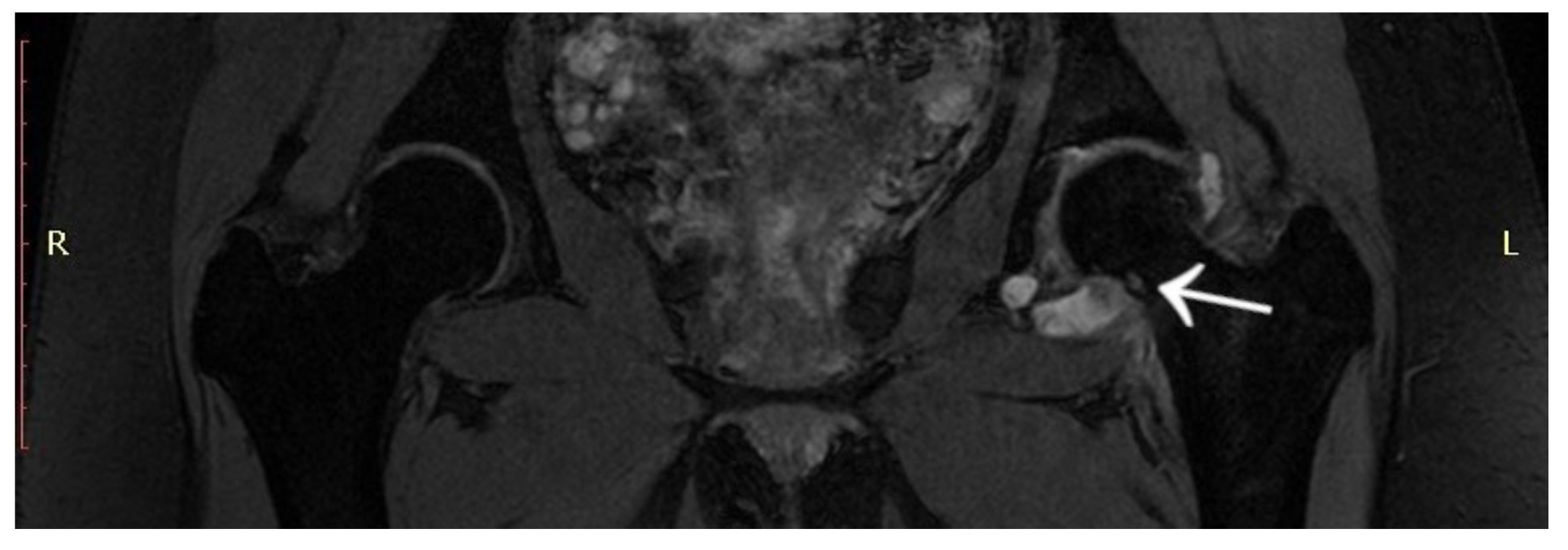 Jcm 12 02721 g012 Jcm 12 02721 g012