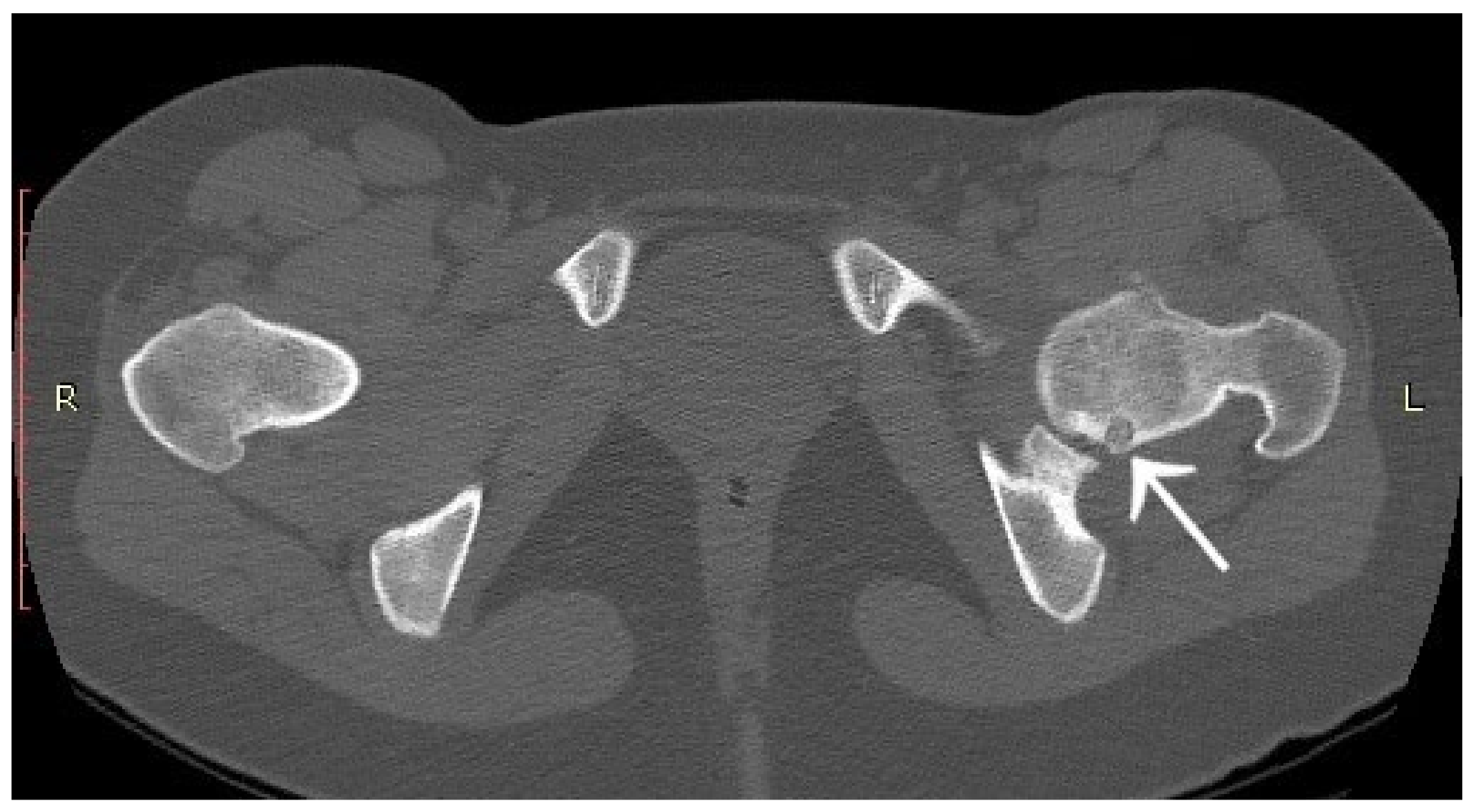 Jcm 12 02721 g013 Jcm 12 02721 g013