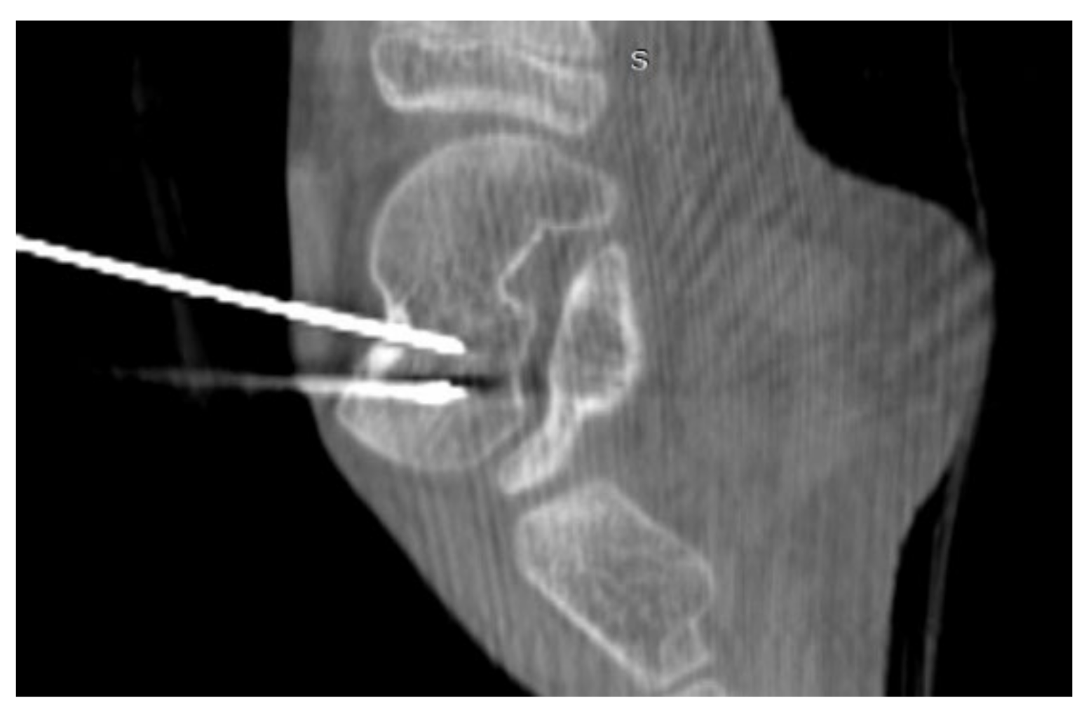 Jcm 12 02721 g018 Jcm 12 02721 g018