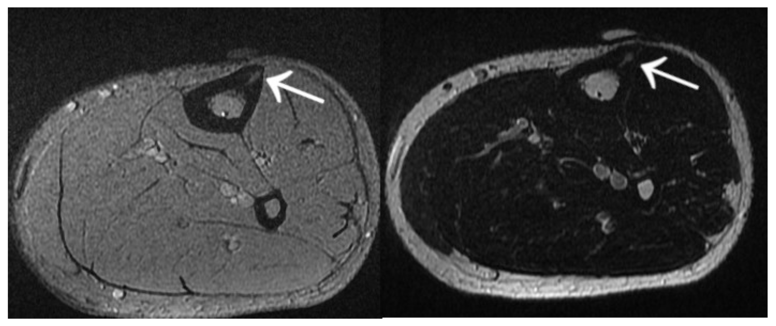 Jcm 12 02721 g020 Jcm 12 02721 g020