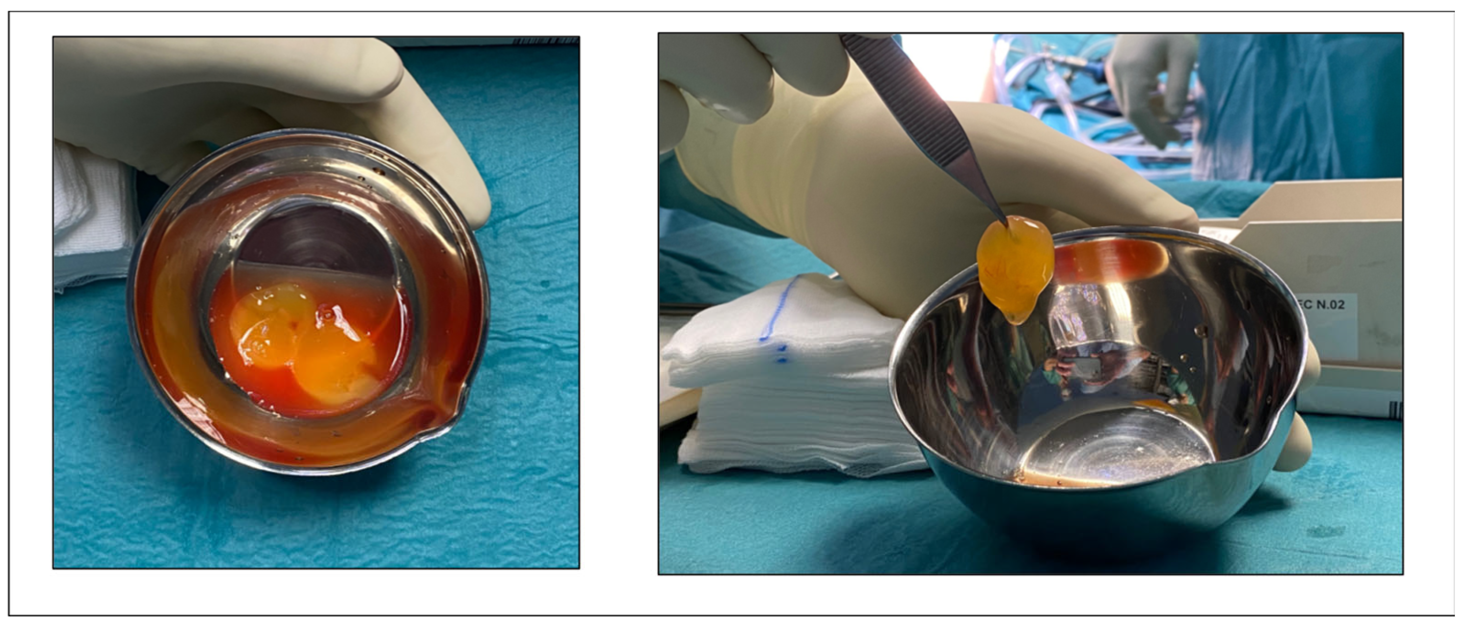 Jcm 12 02747 g003 Jcm 12 02747 g003