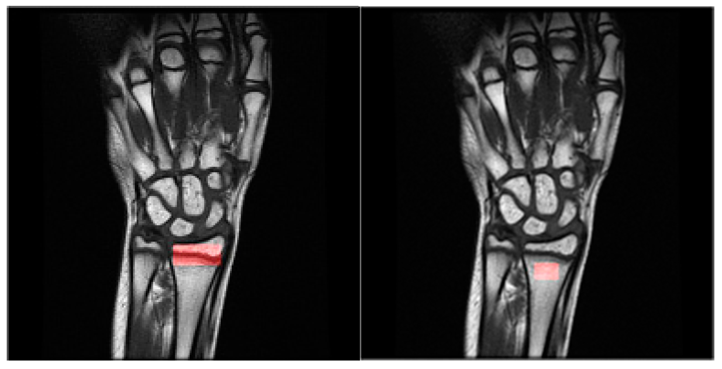 Jcm 12 02762 g002 Jcm 12 02762 g002