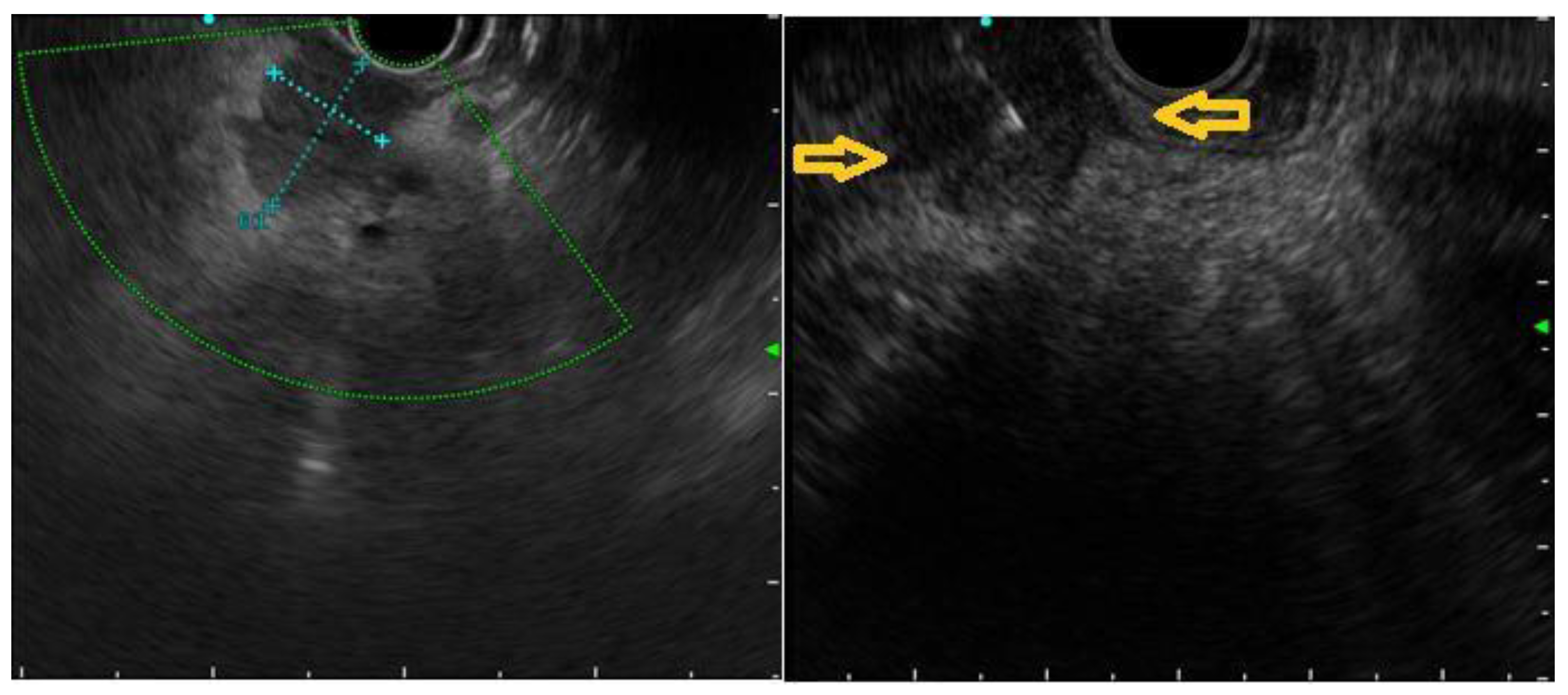 Jcm 12 02829 g002 Jcm 12 02829 g002
