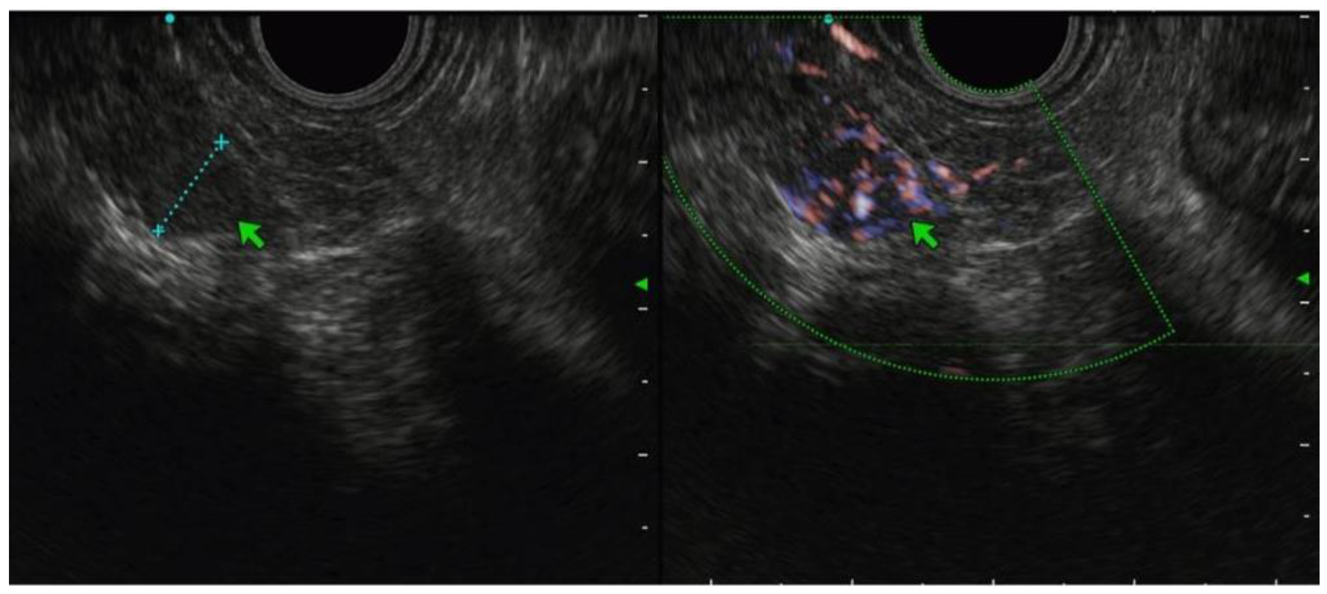 Jcm 12 02829 g003 Jcm 12 02829 g003