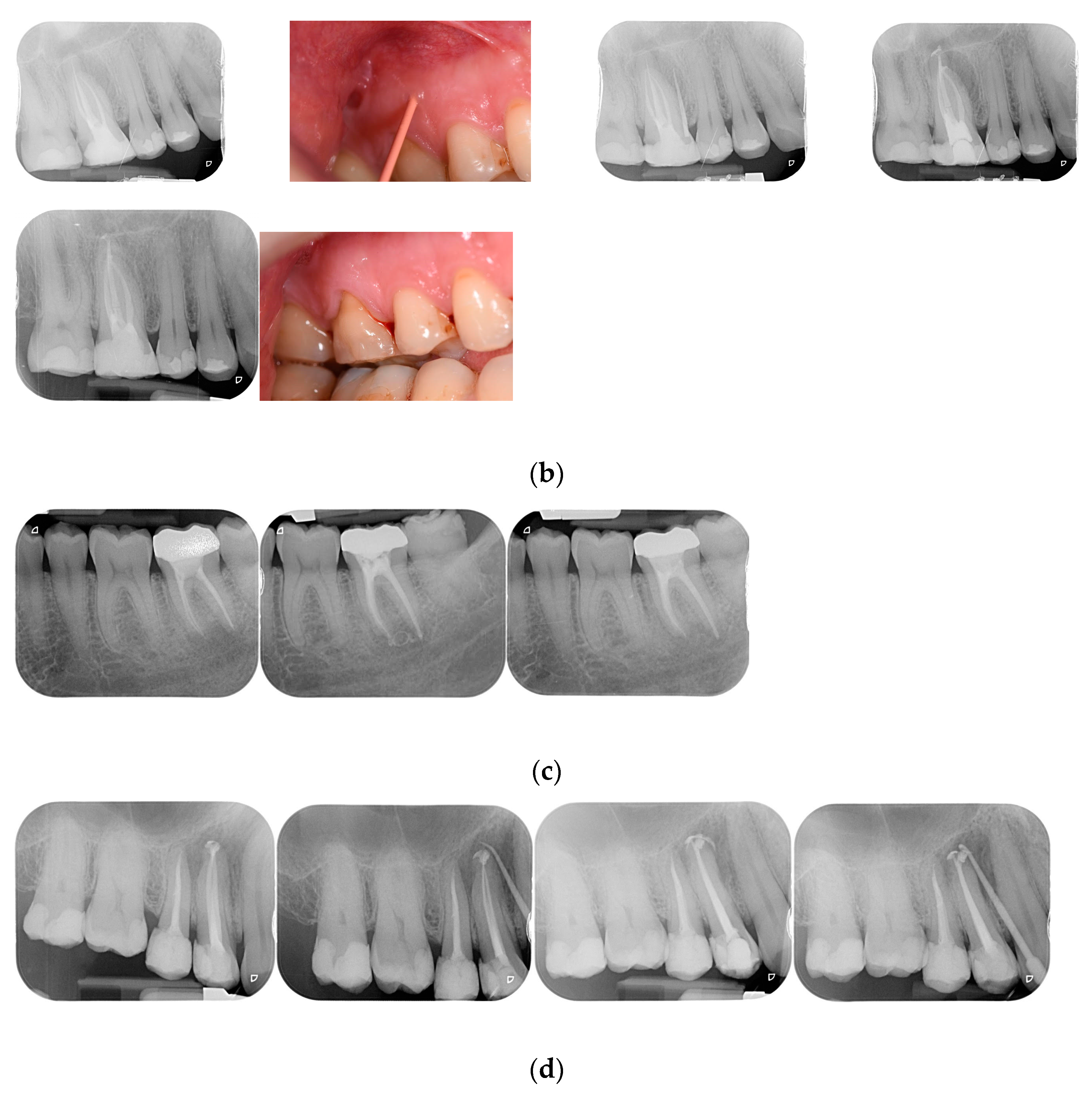 Jcm 12 02867 g001b Jcm 12 02867 g001b