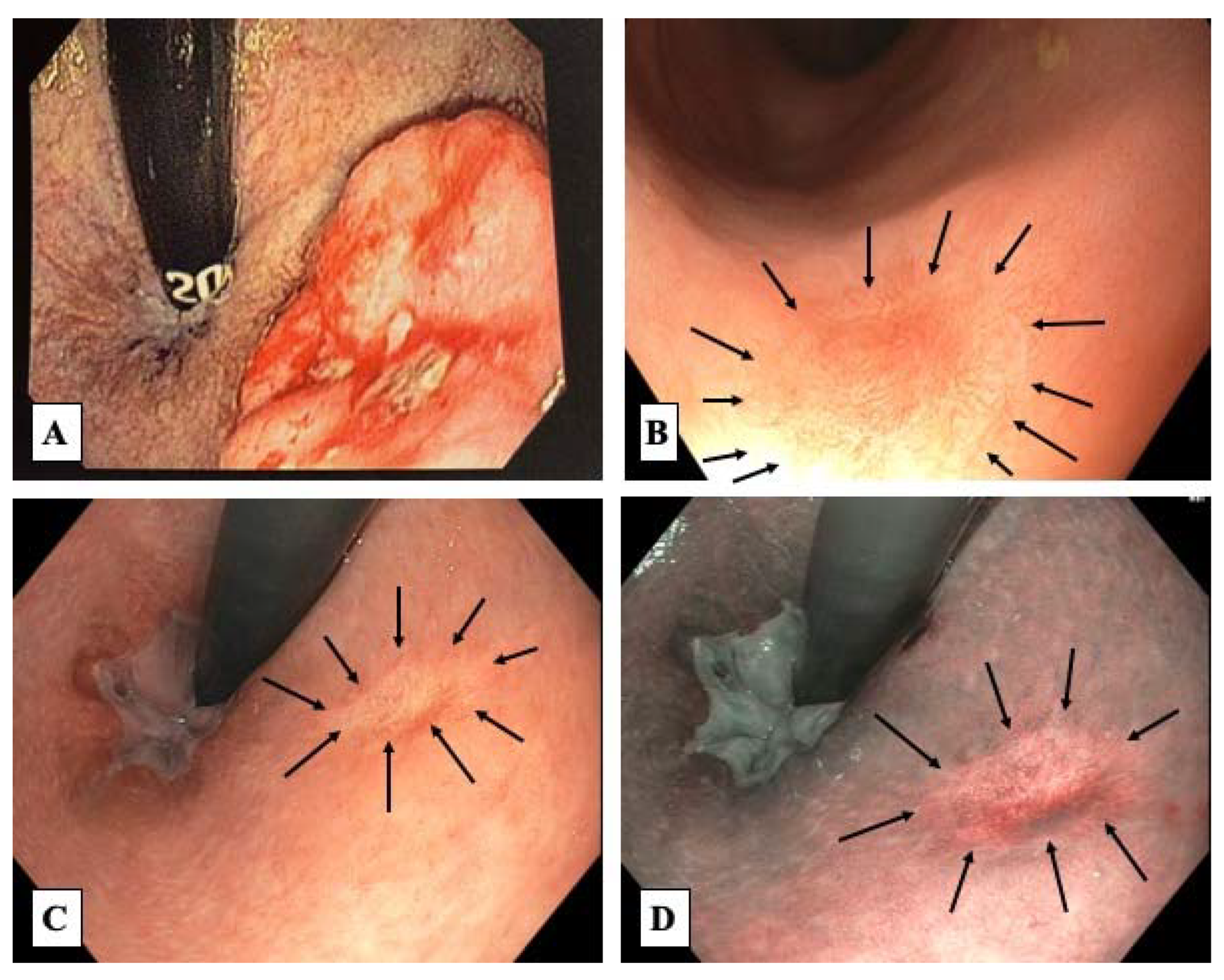 Jcm 12 02873 g002 Jcm 12 02873 g002
