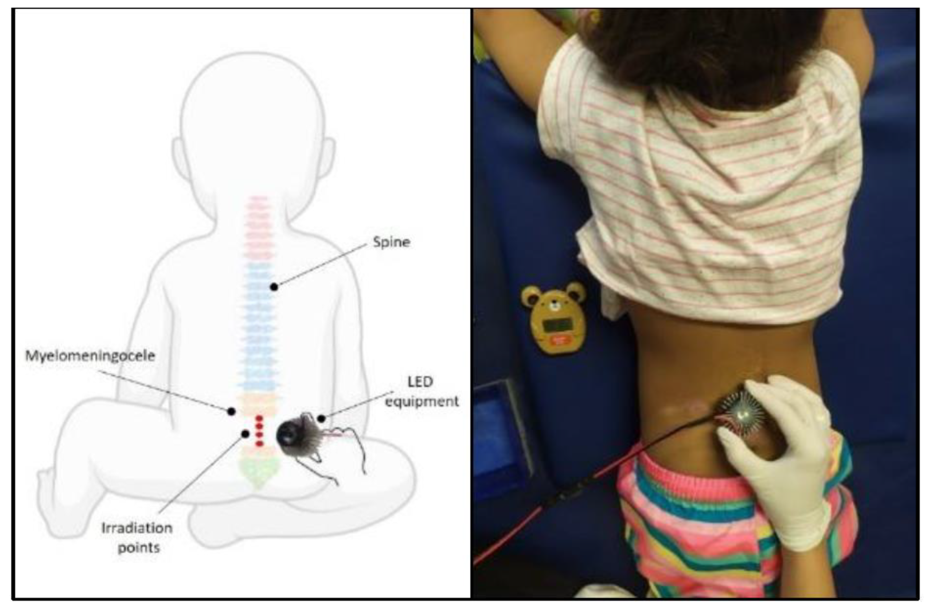 Jcm 12 02920 g001 Jcm 12 02920 g001