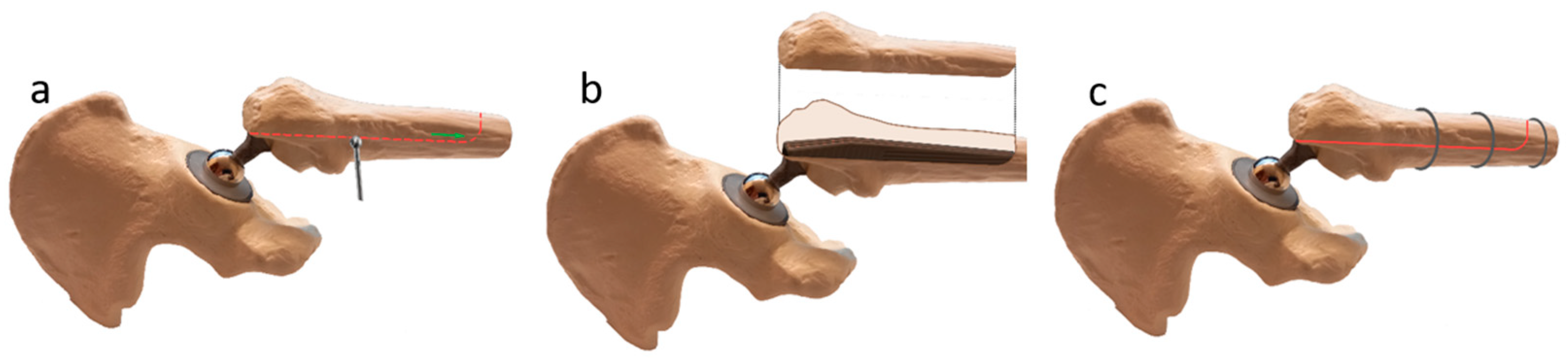 Jcm 12 02947 g001 Jcm 12 02947 g001