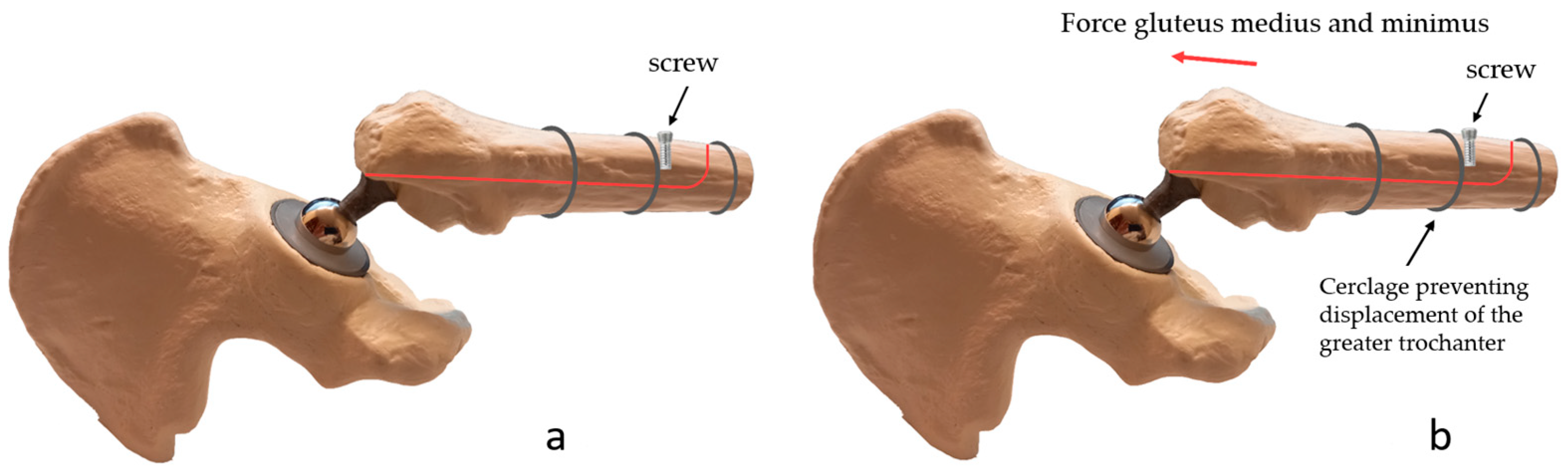 Jcm 12 02947 g004 Jcm 12 02947 g004