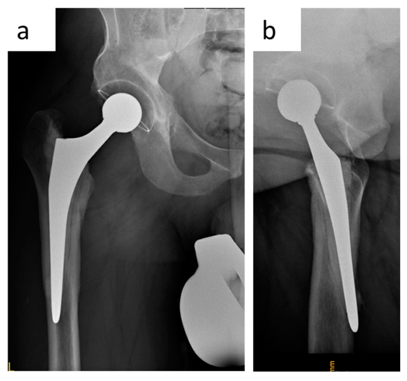 Jcm 12 02947 g005 Jcm 12 02947 g005
