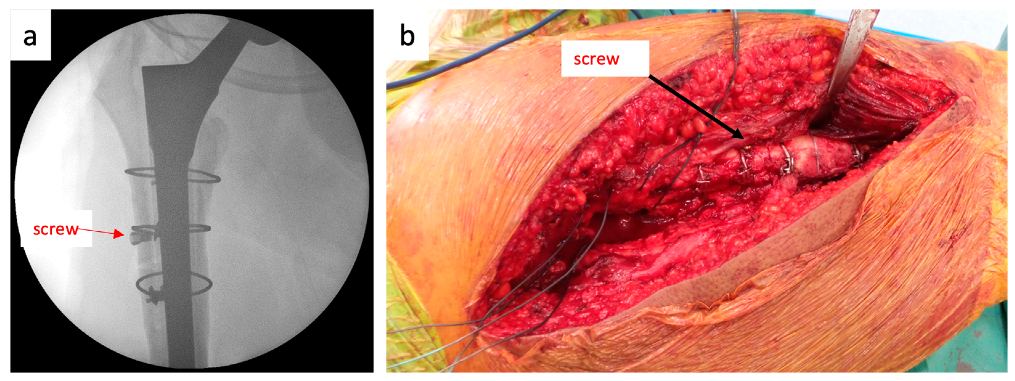 Jcm 12 02947 g006 Jcm 12 02947 g006
