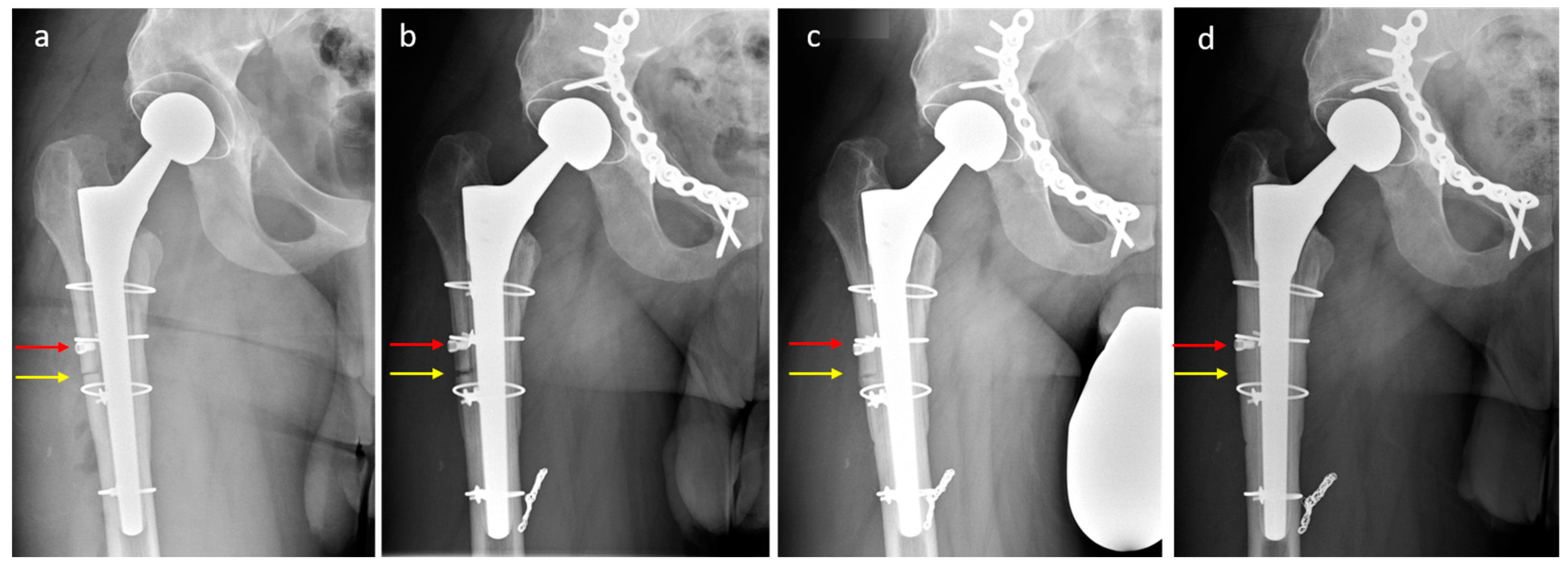 Jcm 12 02947 g007 Jcm 12 02947 g007