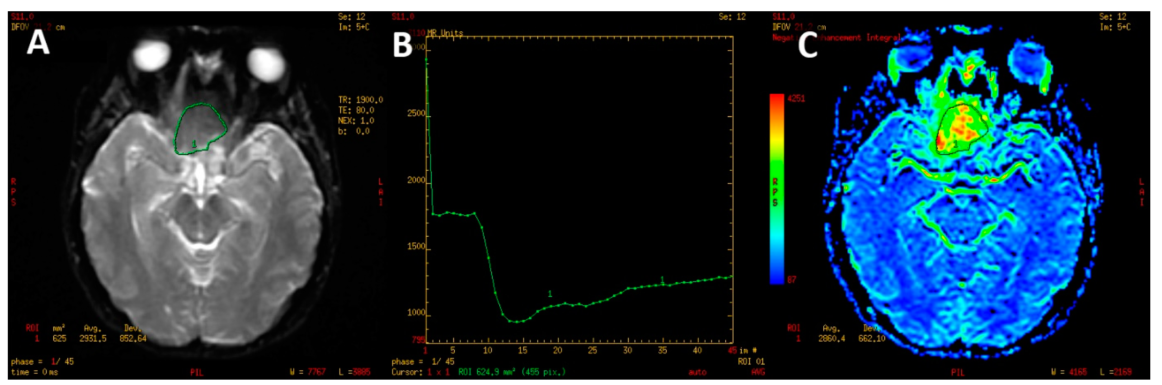 Jcm 12 02957 g002 Jcm 12 02957 g002