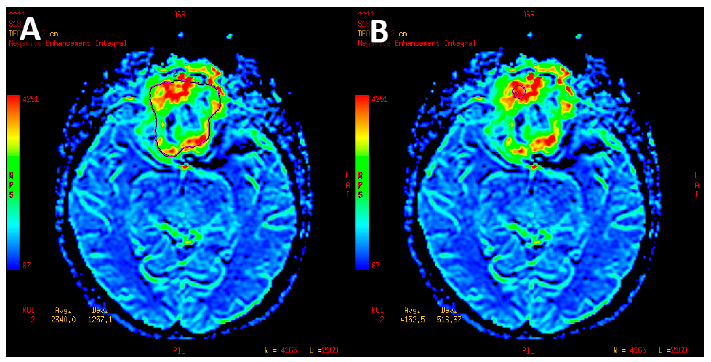 Jcm 12 02957 g004 Jcm 12 02957 g004