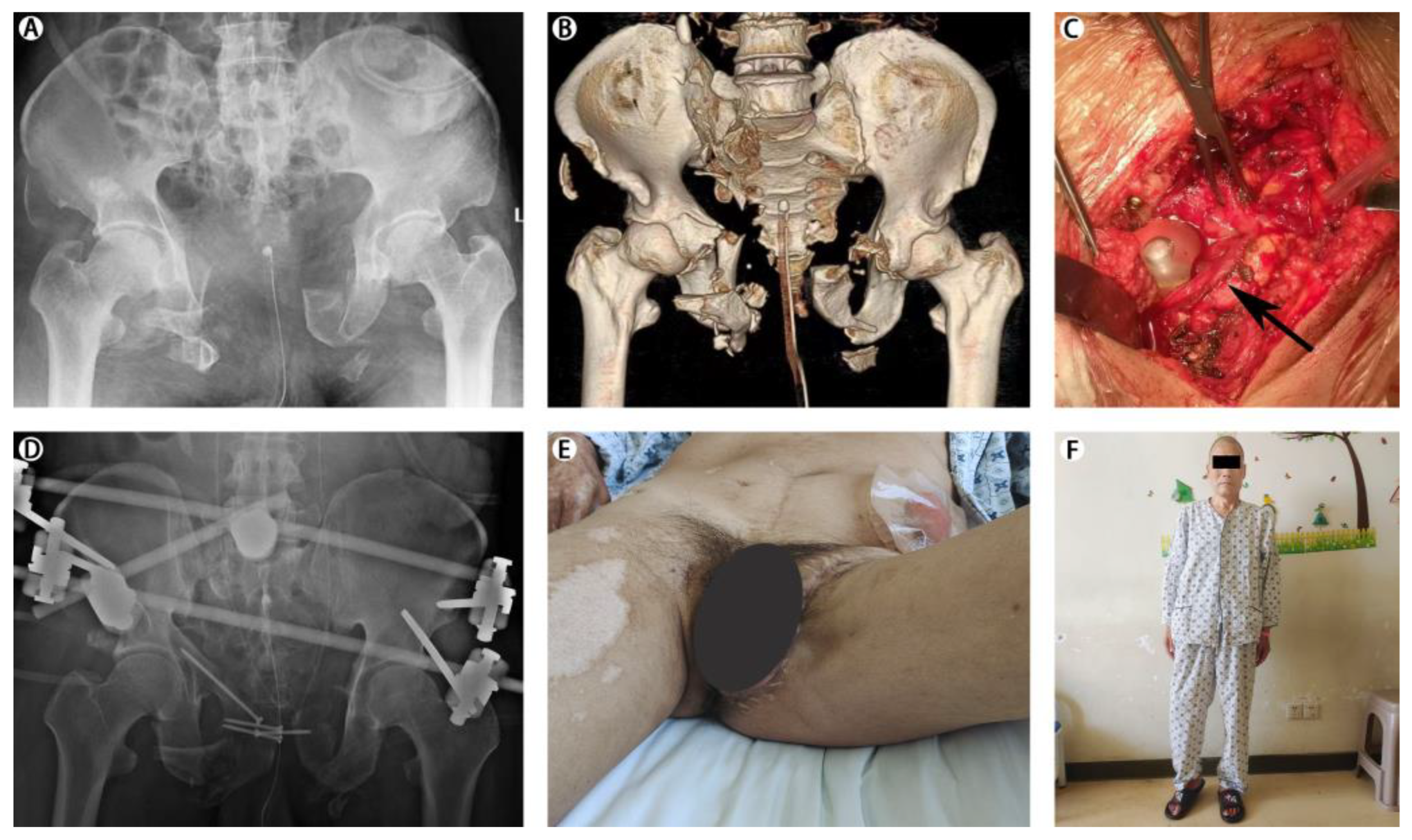 Pelvis and Perineum | Basicmedical Key