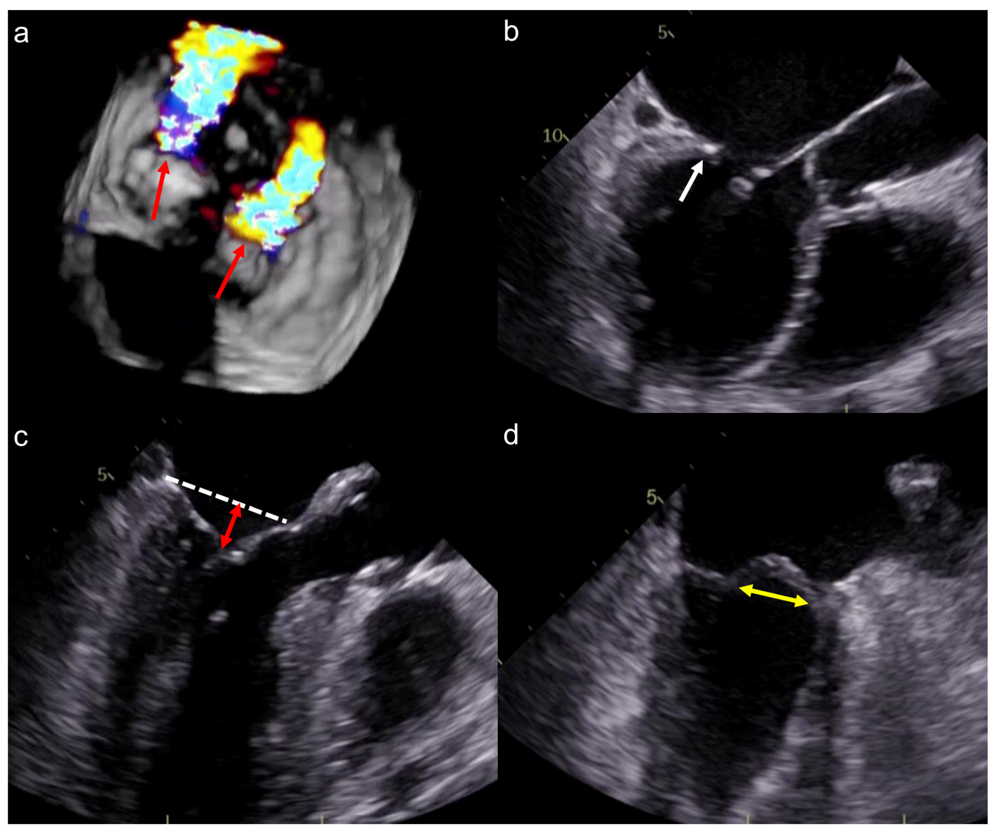Jcm 12 02978 g004 Jcm 12 02978 g004