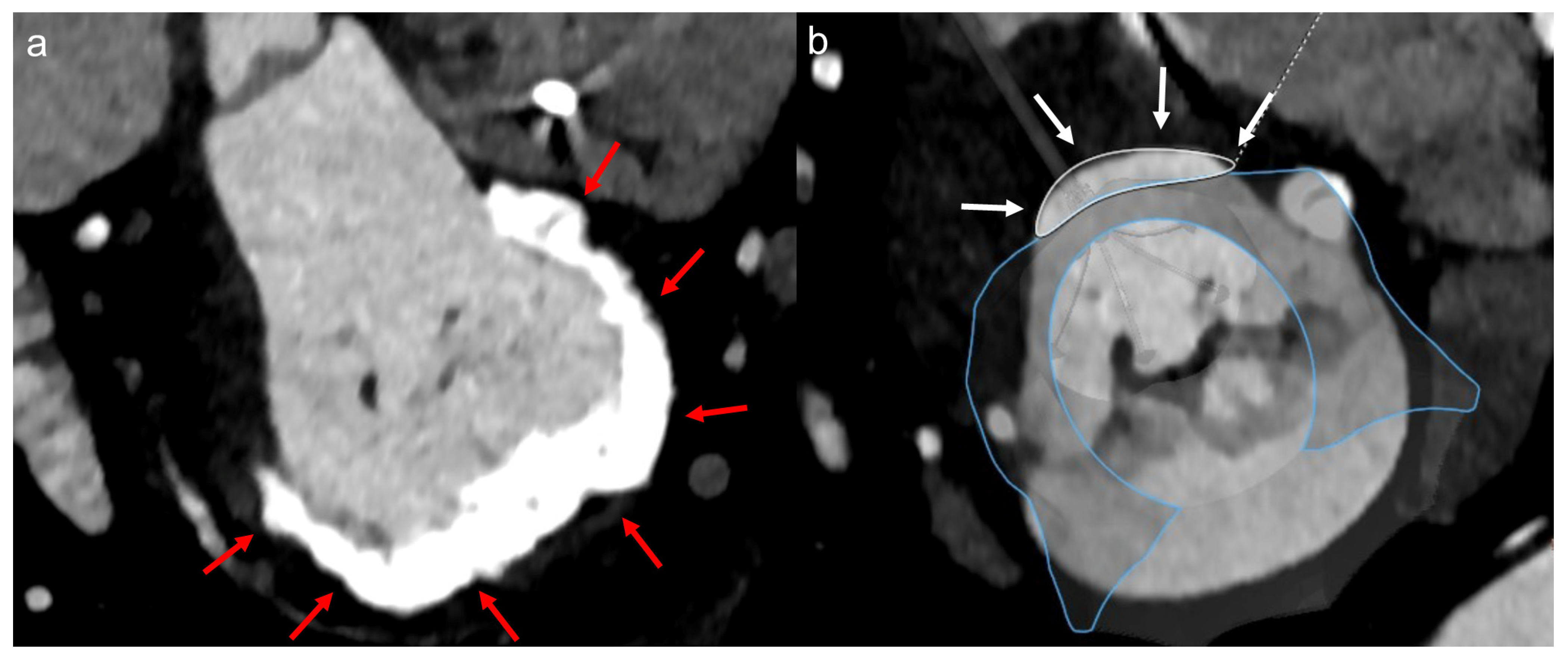 Jcm 12 02978 g005 Jcm 12 02978 g005