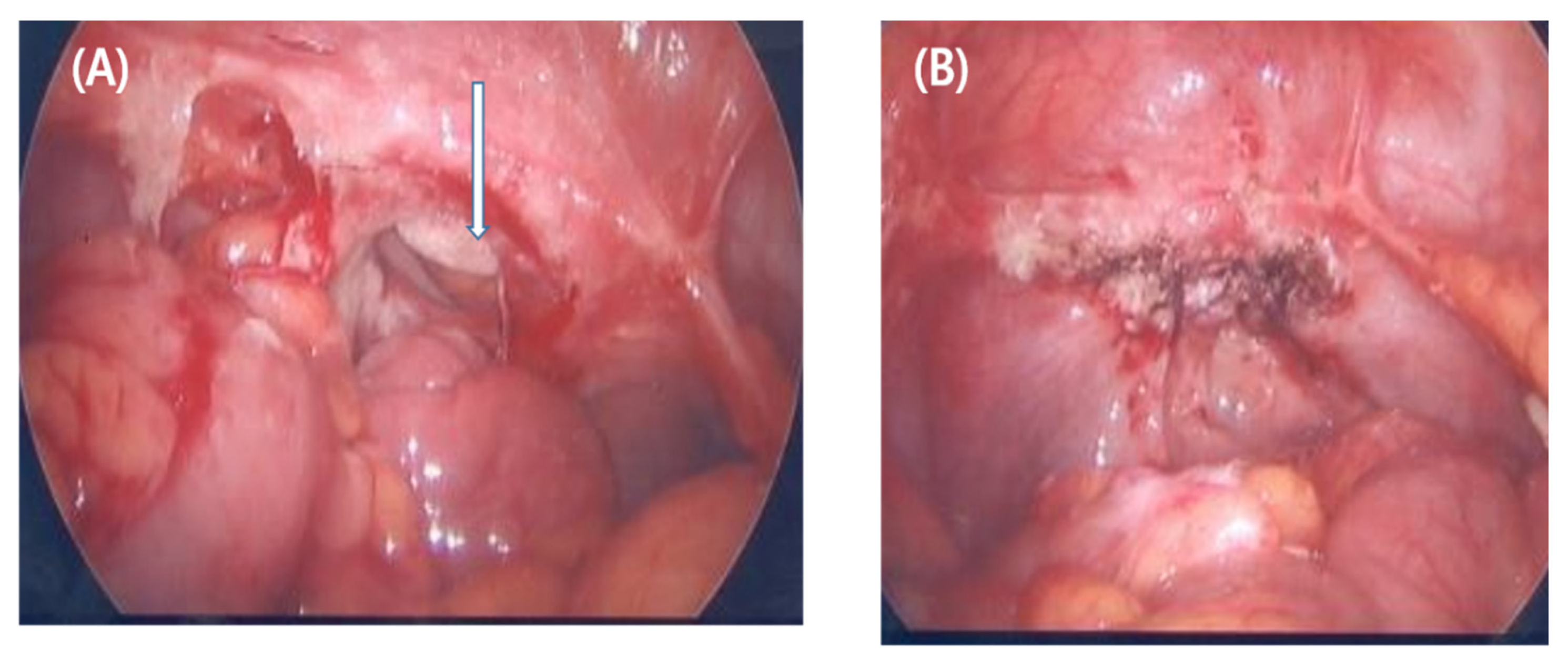 Jcm 12 03001 g002 Jcm 12 03001 g002