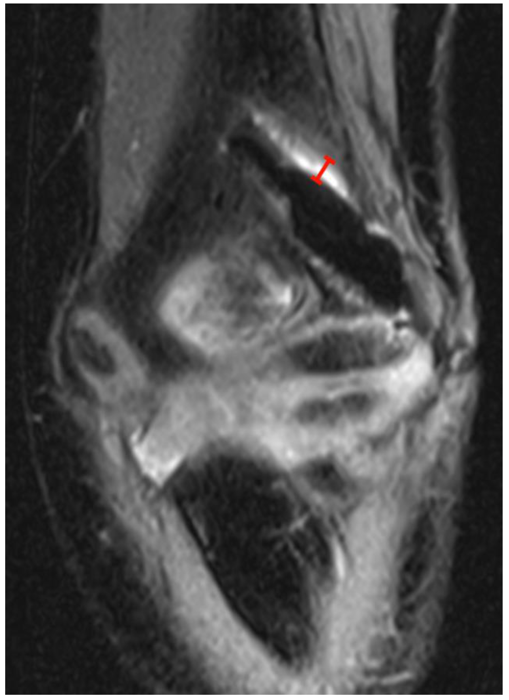 Jcm 12 03016 g002 Jcm 12 03016 g002