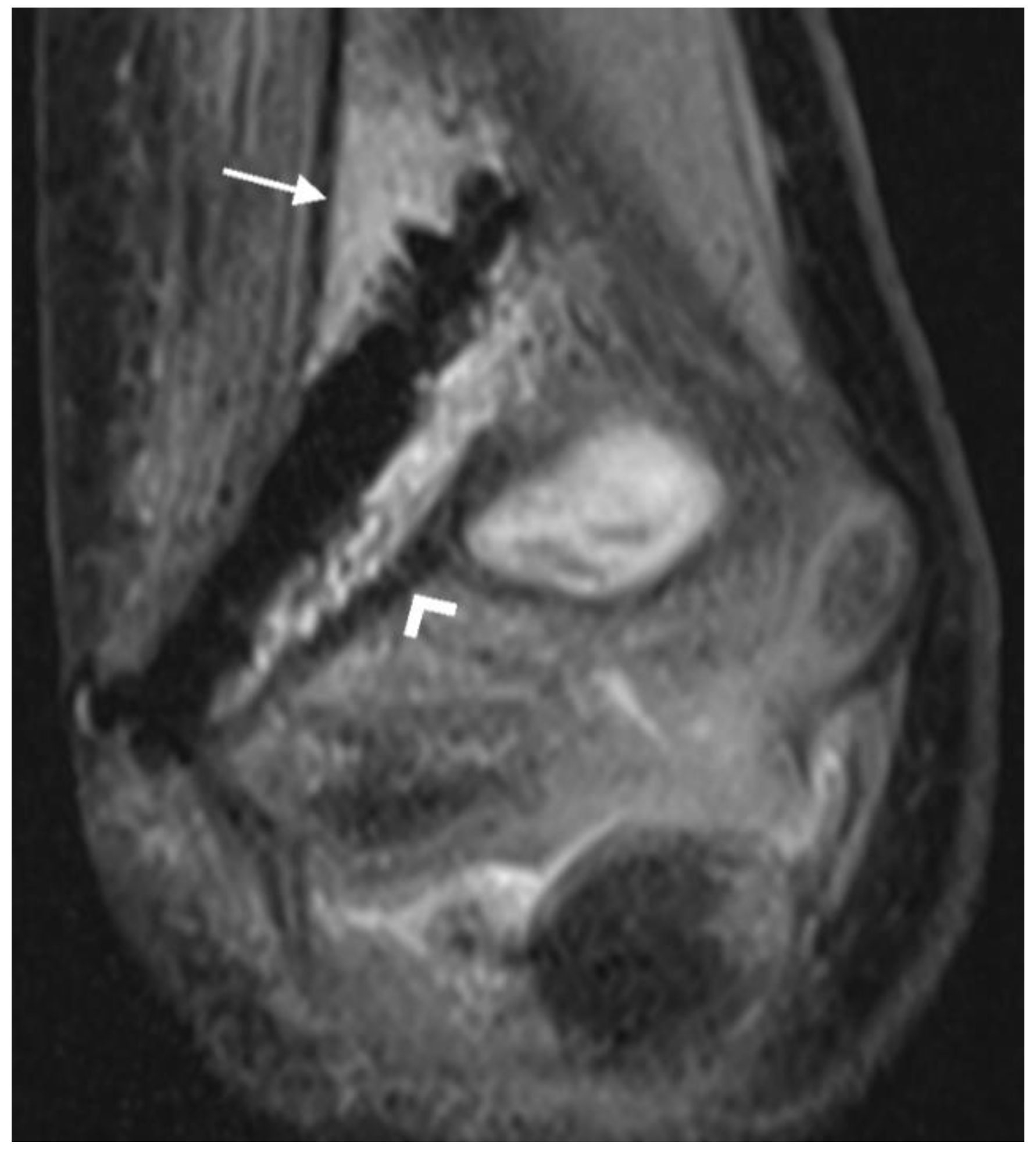 Jcm 12 03016 g003 Jcm 12 03016 g003