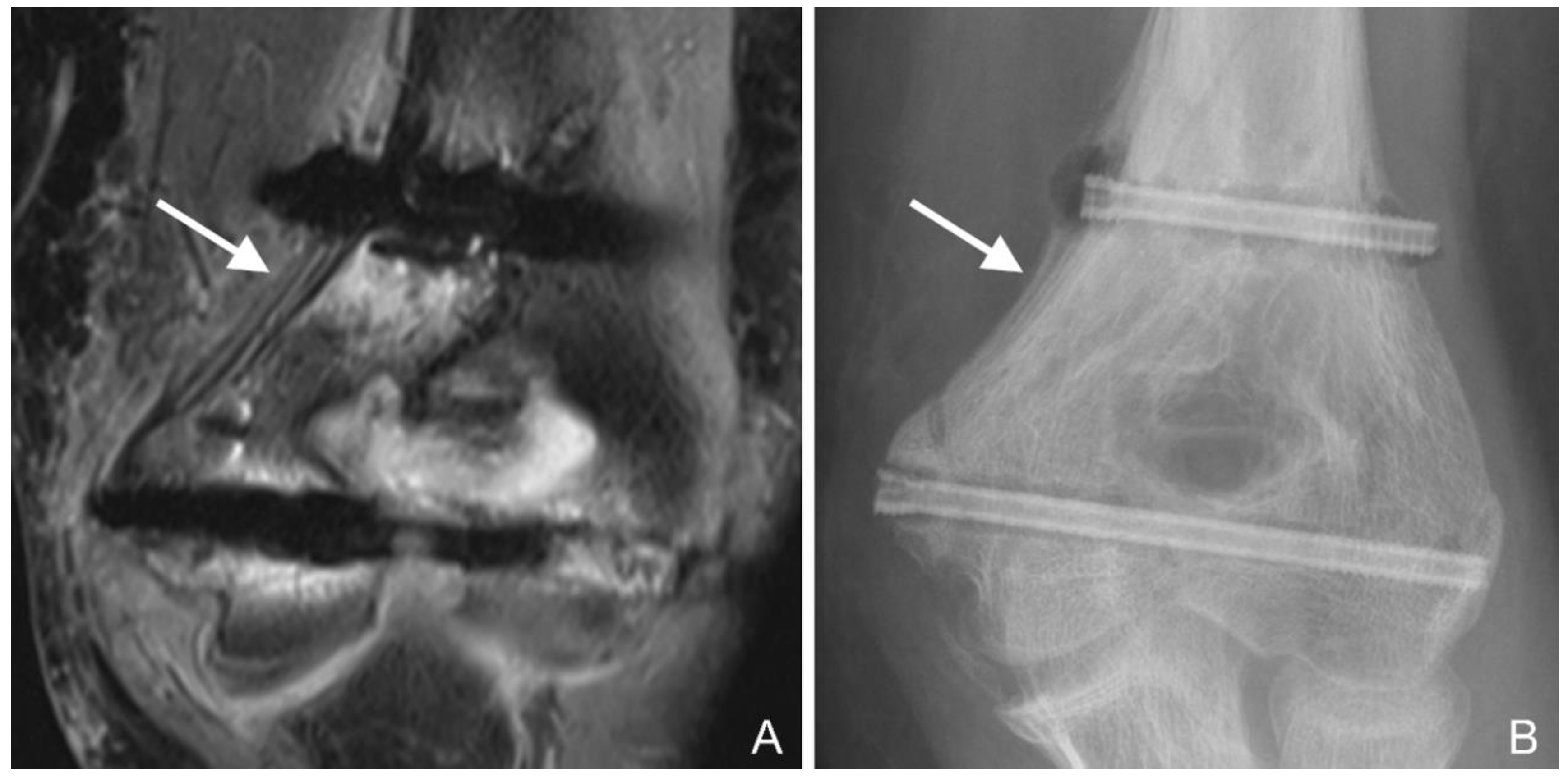 Jcm 12 03016 g004 Jcm 12 03016 g004