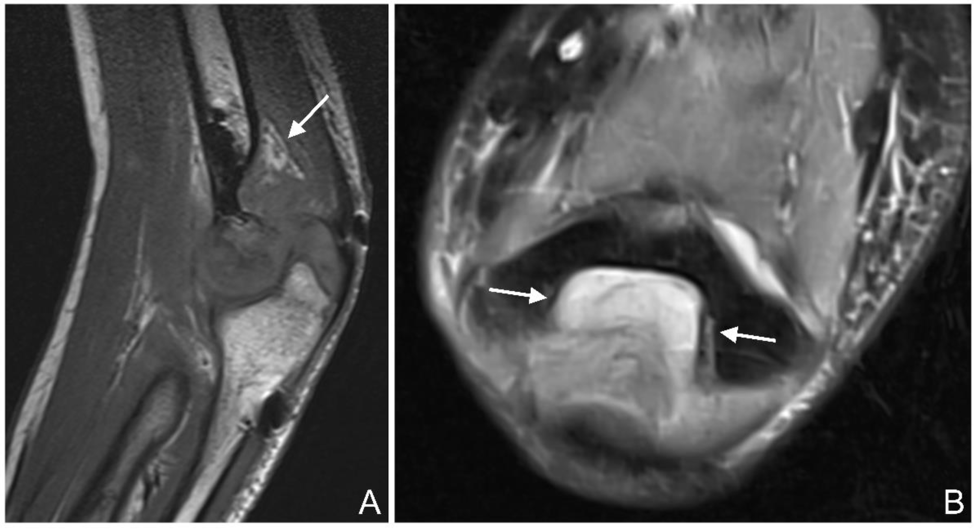Jcm 12 03016 g006 Jcm 12 03016 g006