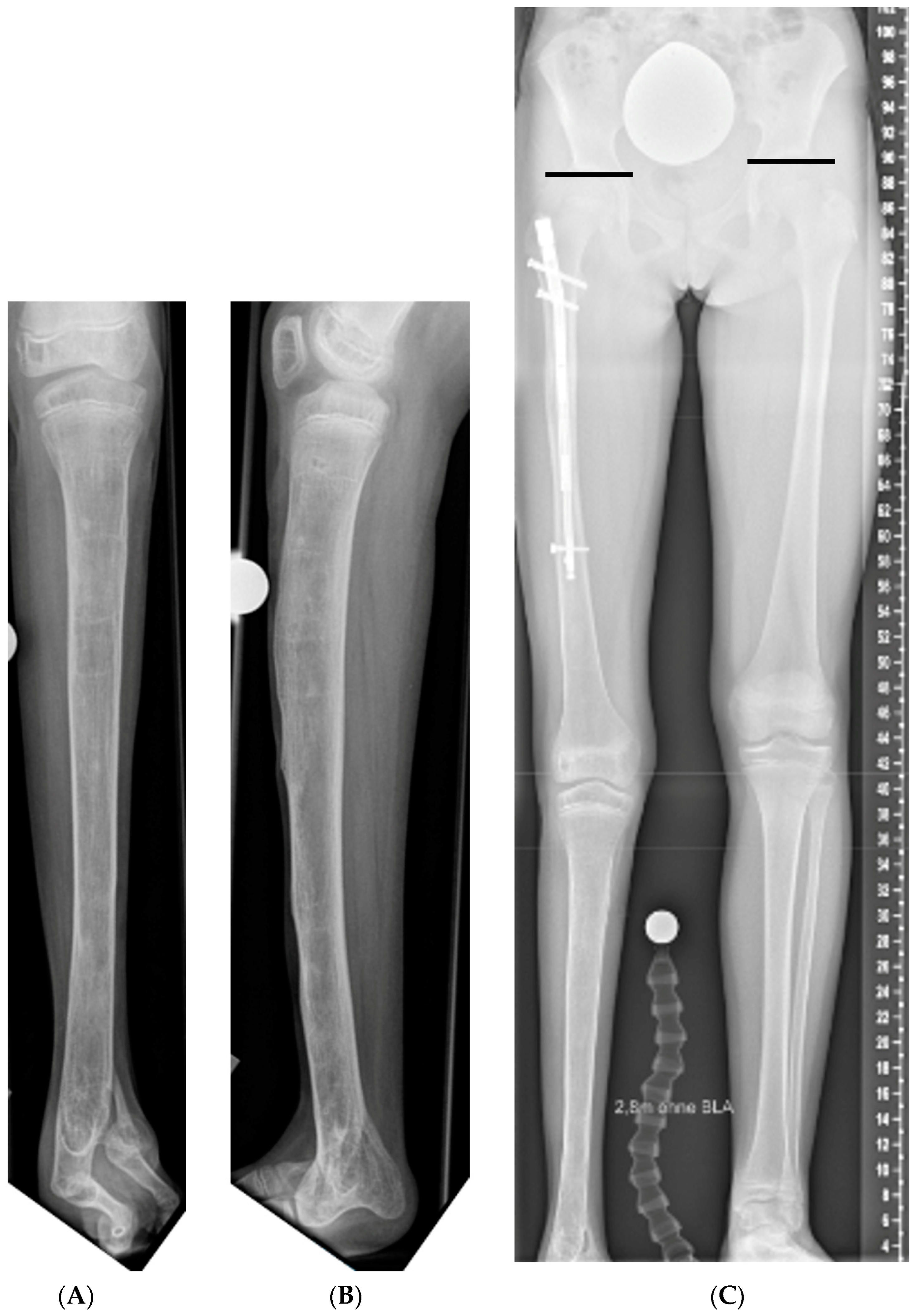 Jcm 12 03022 g002 Jcm 12 03022 g002