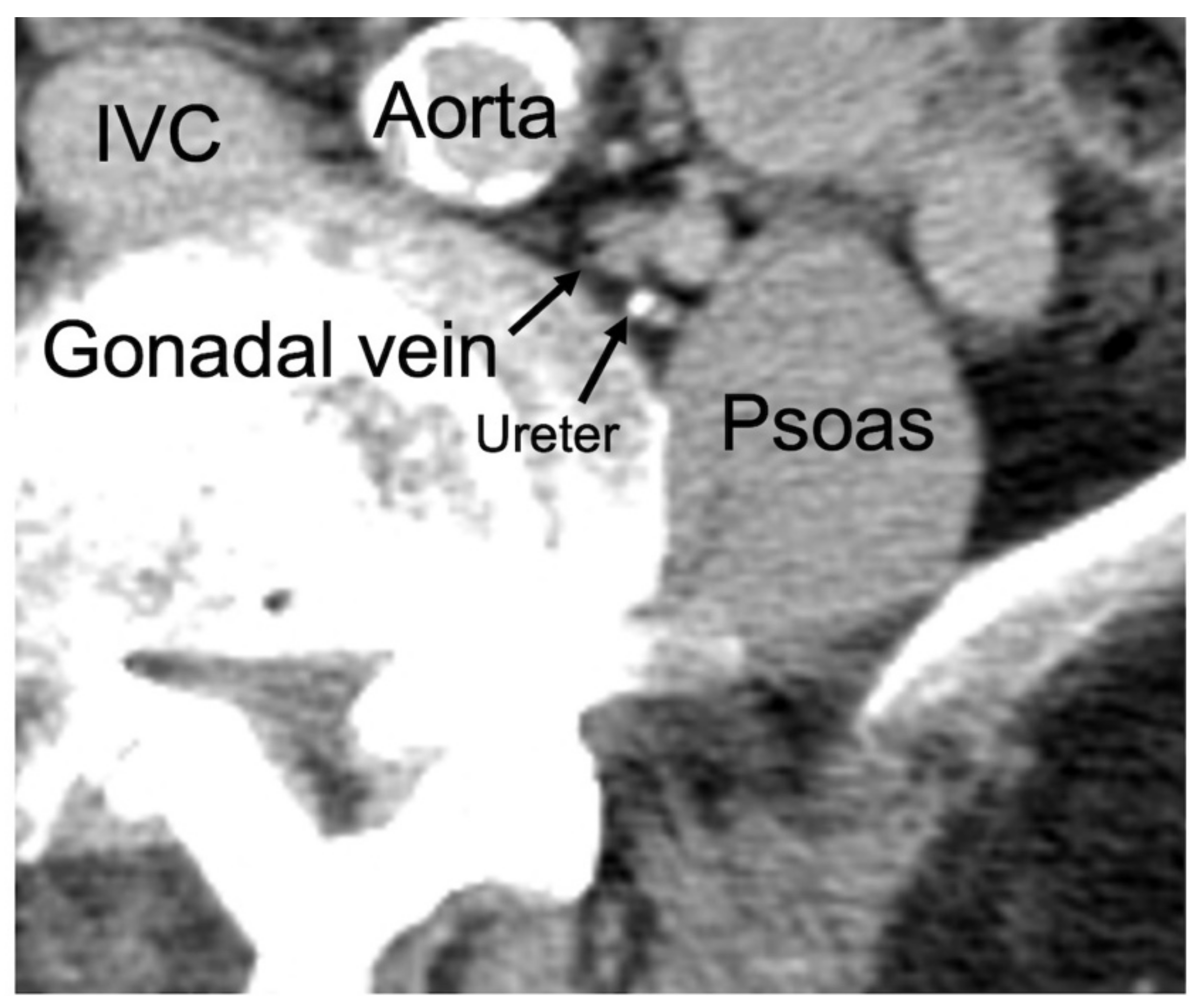 Jcm 12 03041 g001 Jcm 12 03041 g001