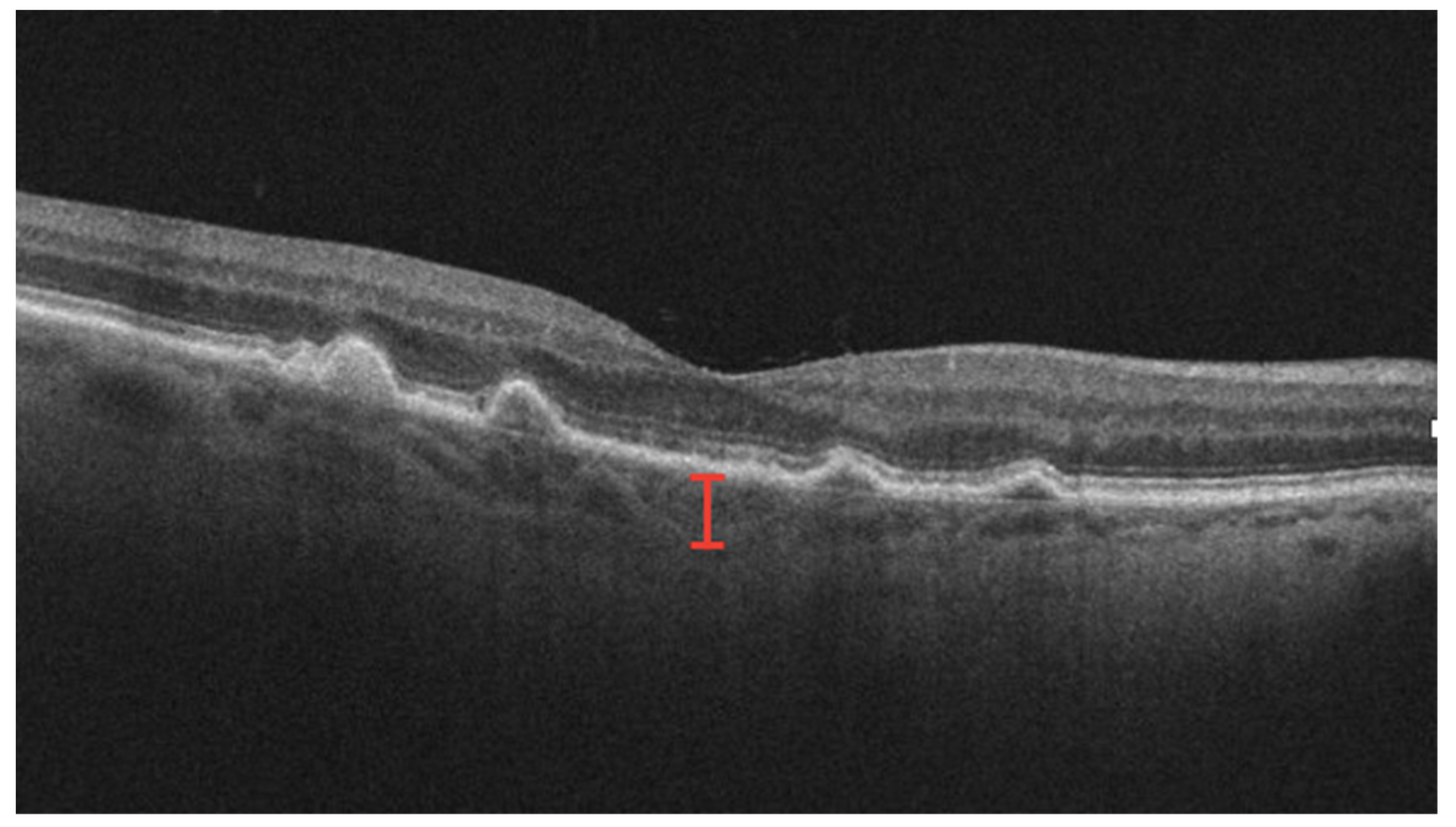 Jcm 12 03049 g006 Jcm 12 03049 g006