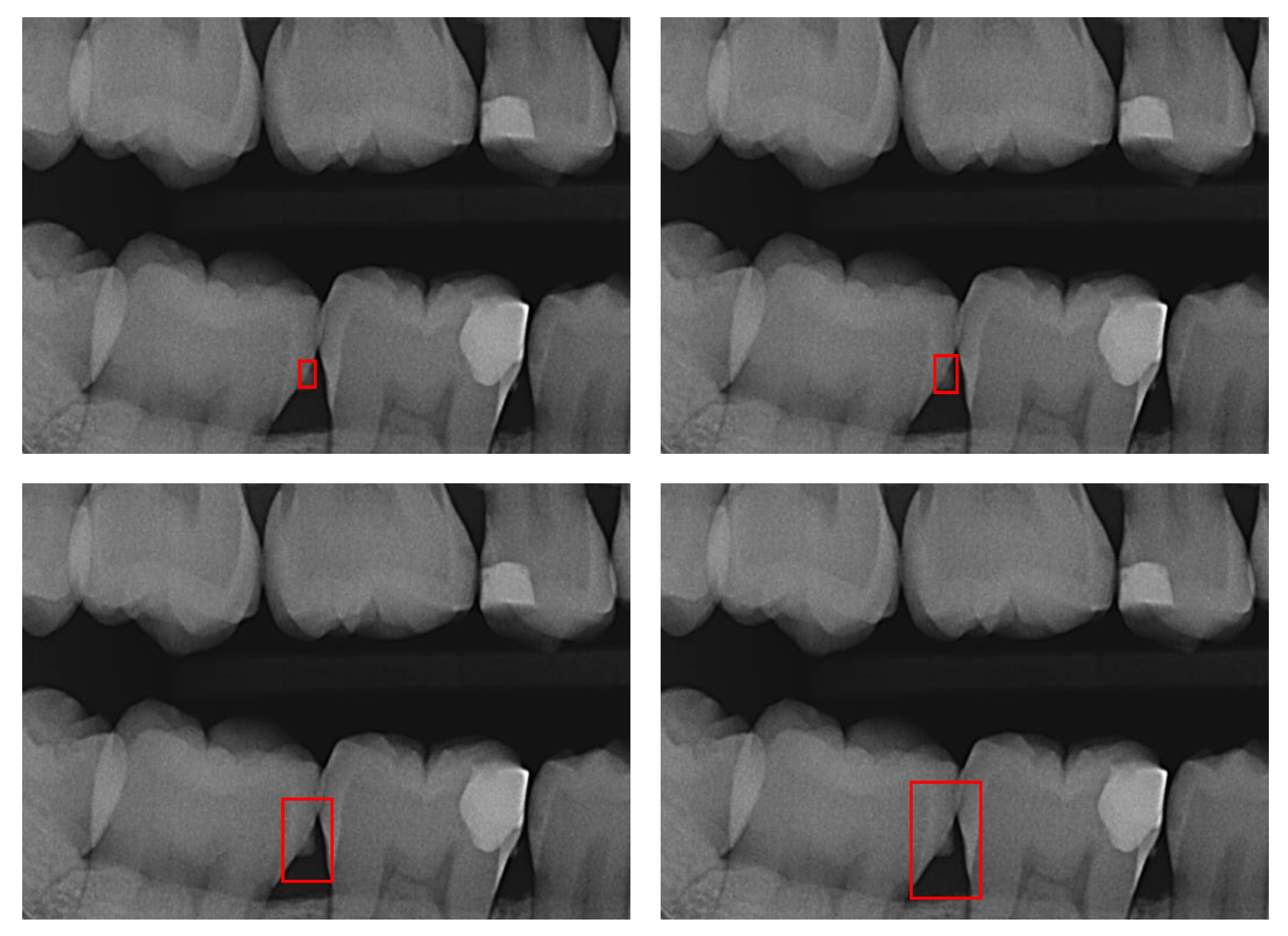 JCM Free FullText Impact of Noisy Labels on Dental Deep Learning