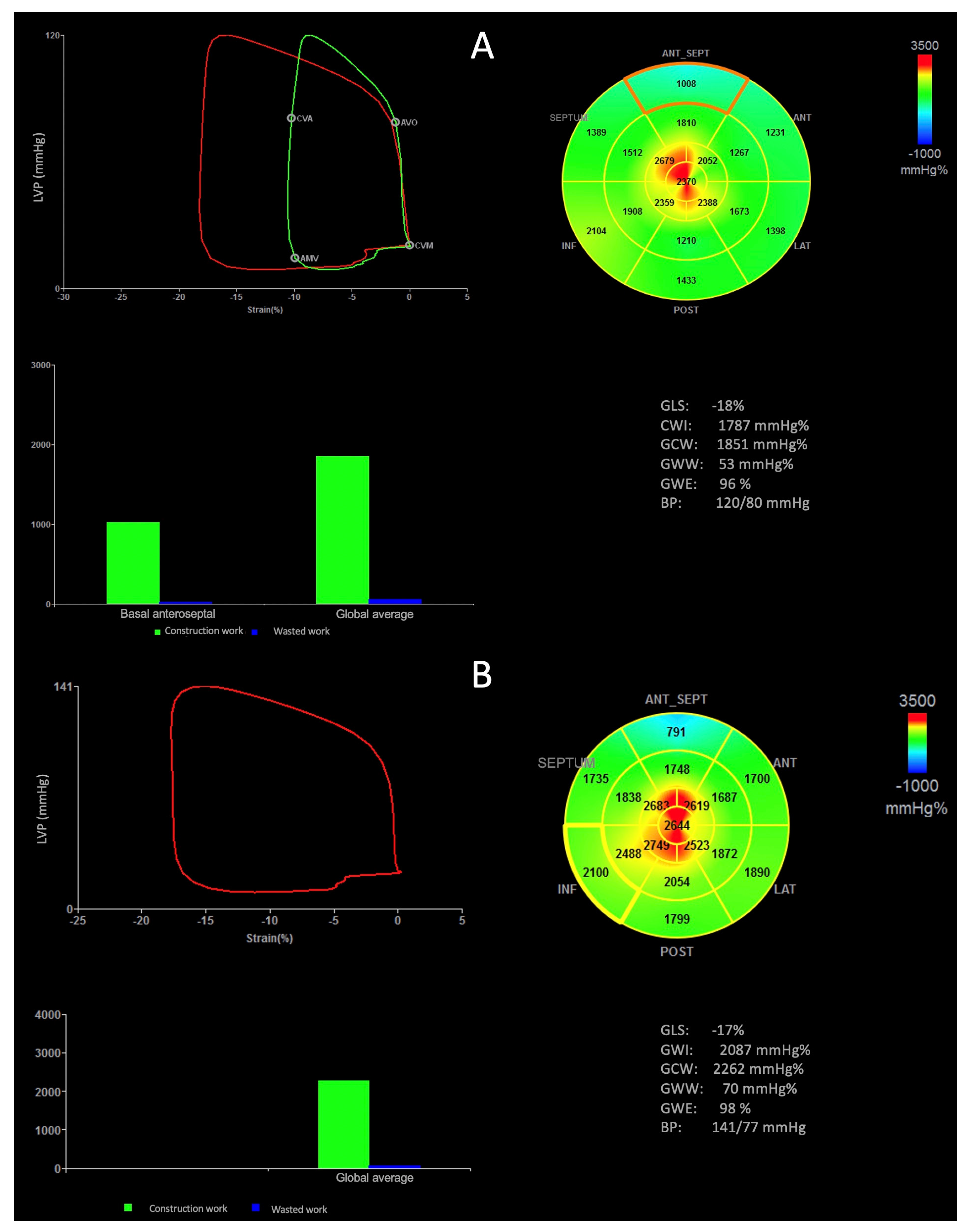 JCM | Free Full-Text | Myocardial Work Index in Professional