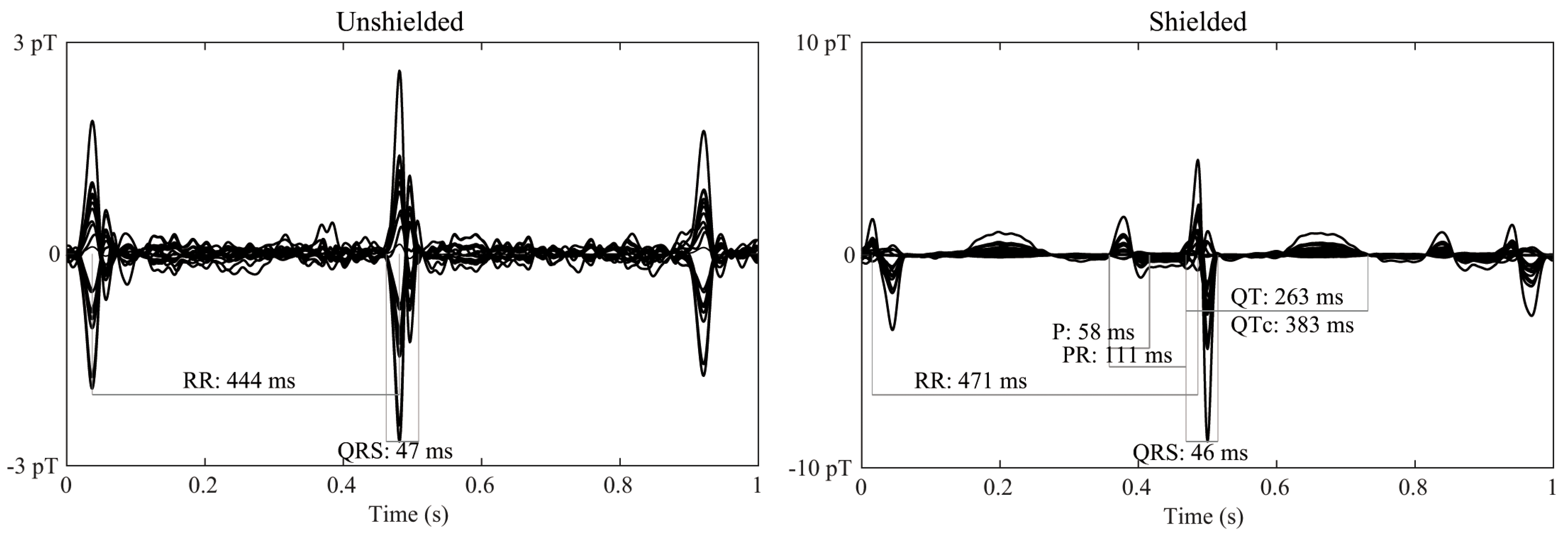 JCM Free FullText Ferrite Shield to Enhance the Performance of