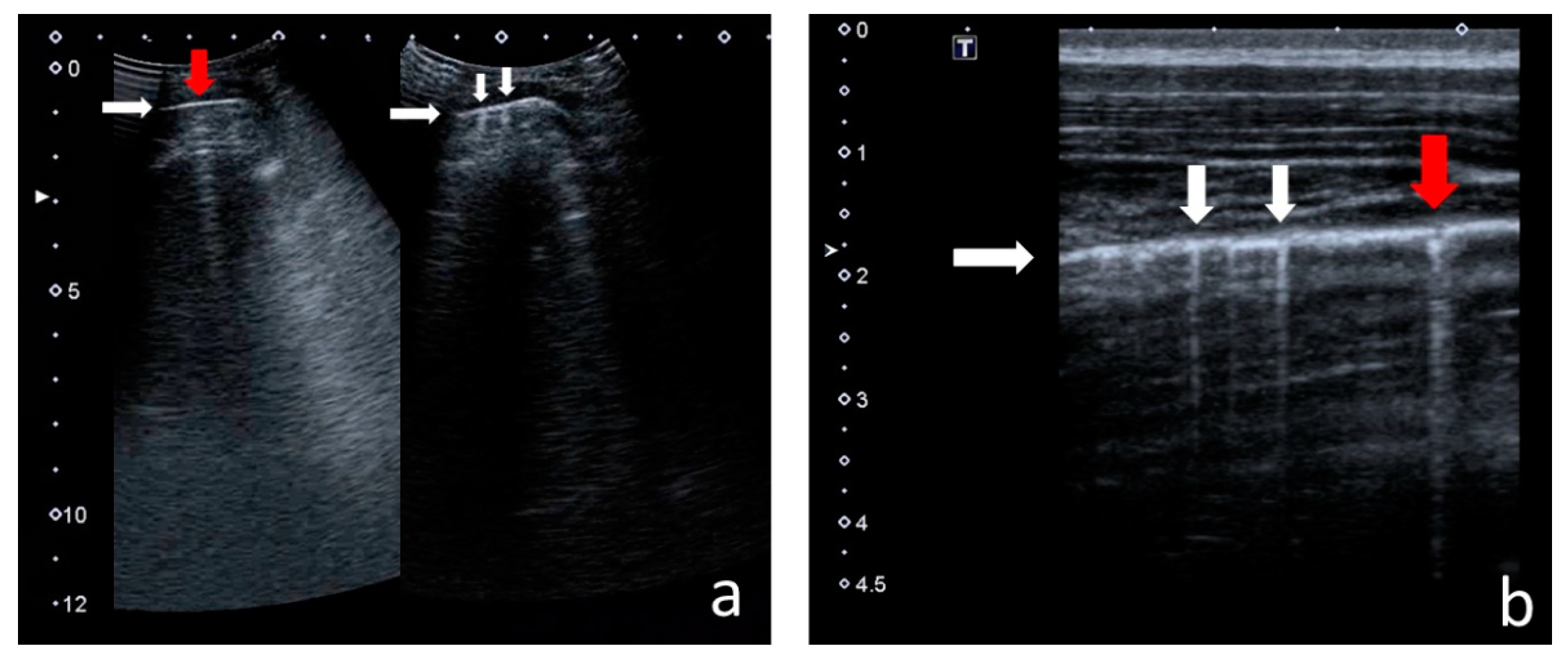 Jcm 12 03086 g001 Jcm 12 03086 g001