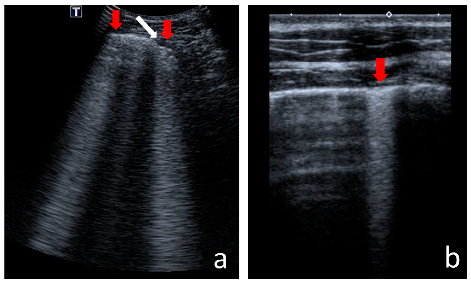 Jcm 12 03086 g003 Jcm 12 03086 g003