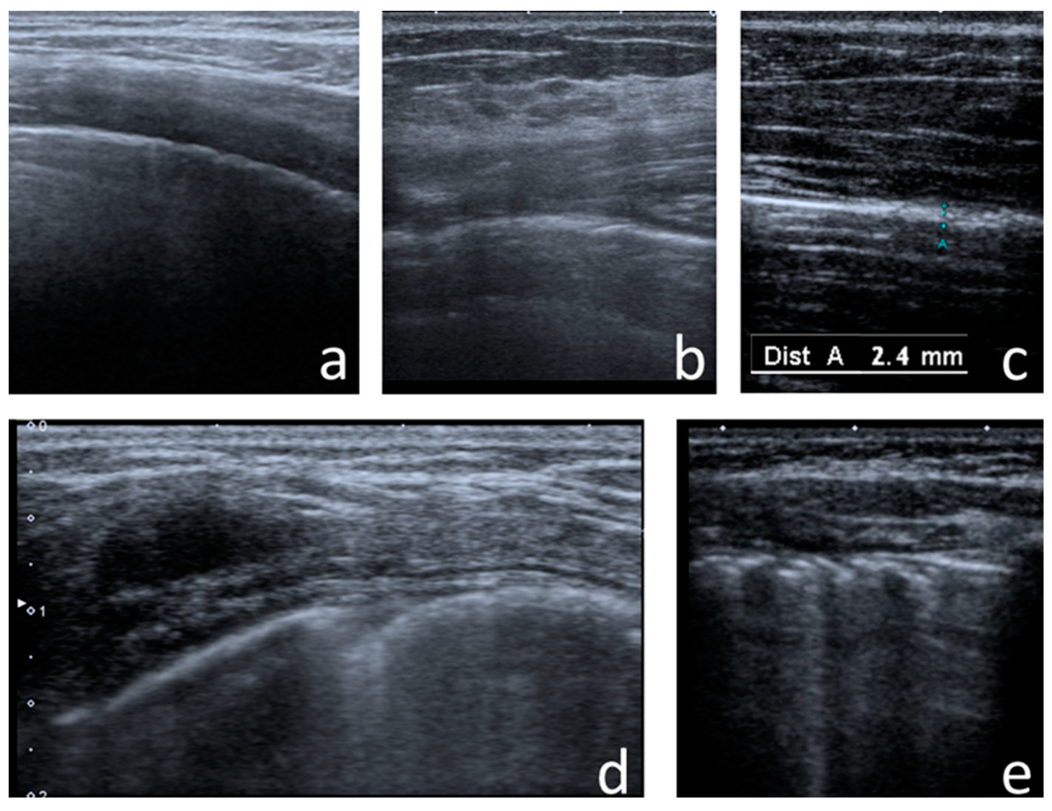 Jcm 12 03086 g005 Jcm 12 03086 g005