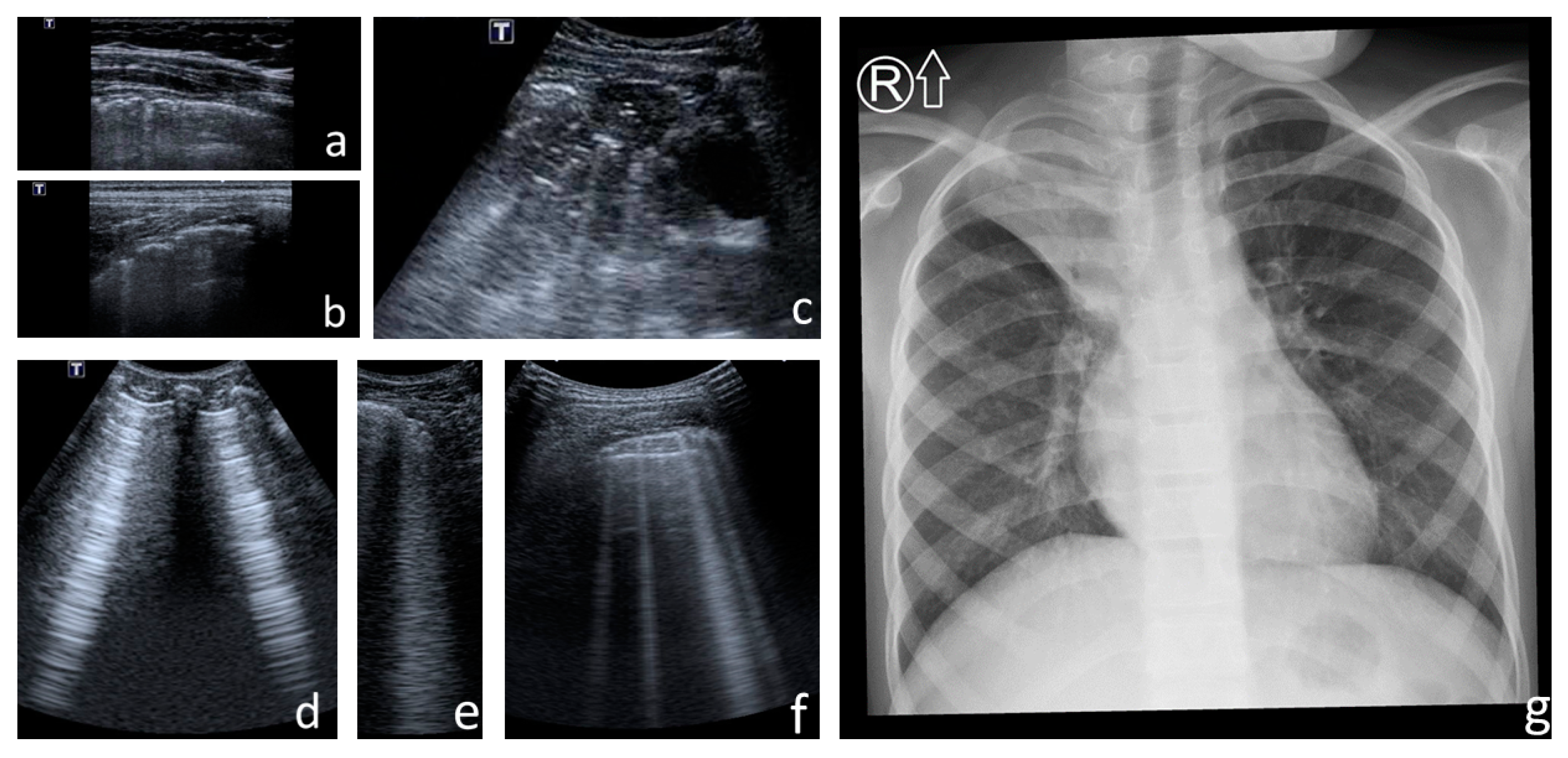 Jcm 12 03086 g013 Jcm 12 03086 g013