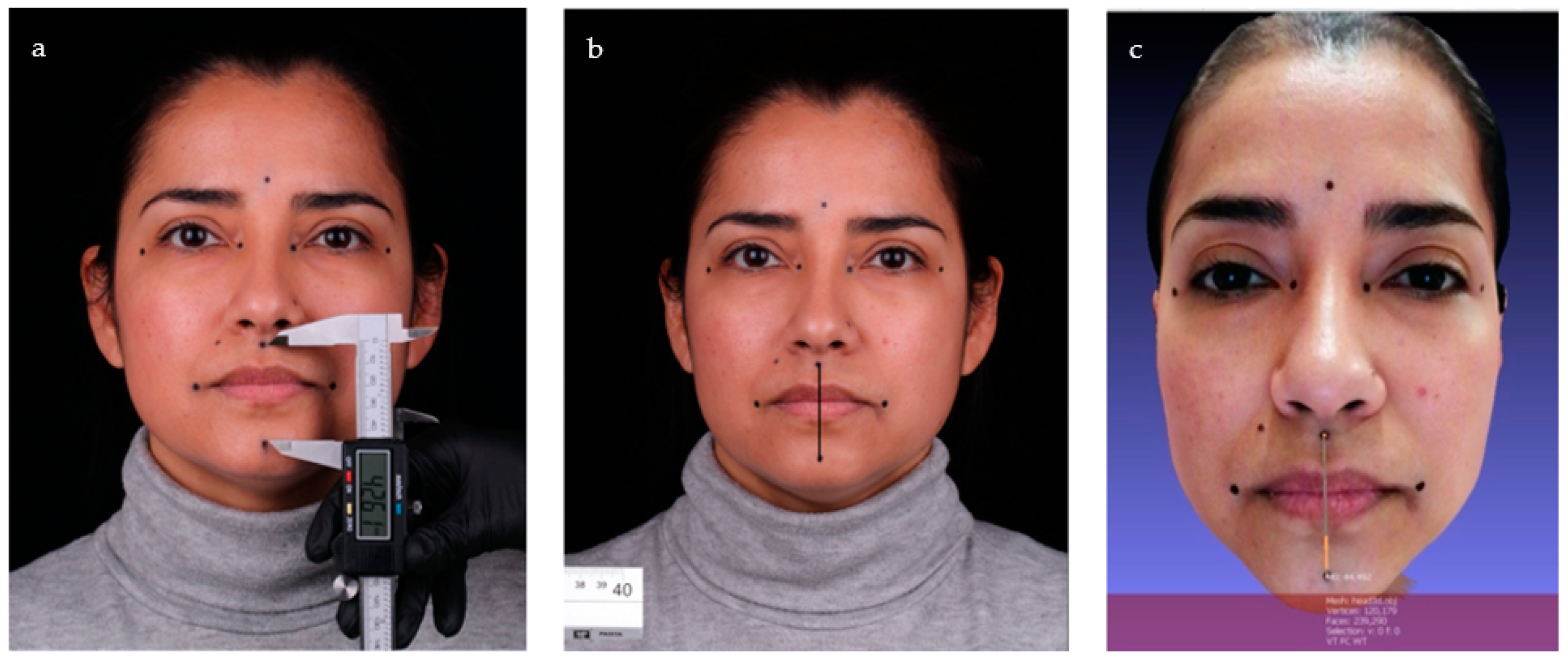 Jcm 12 03090 g002 Jcm 12 03090 g002