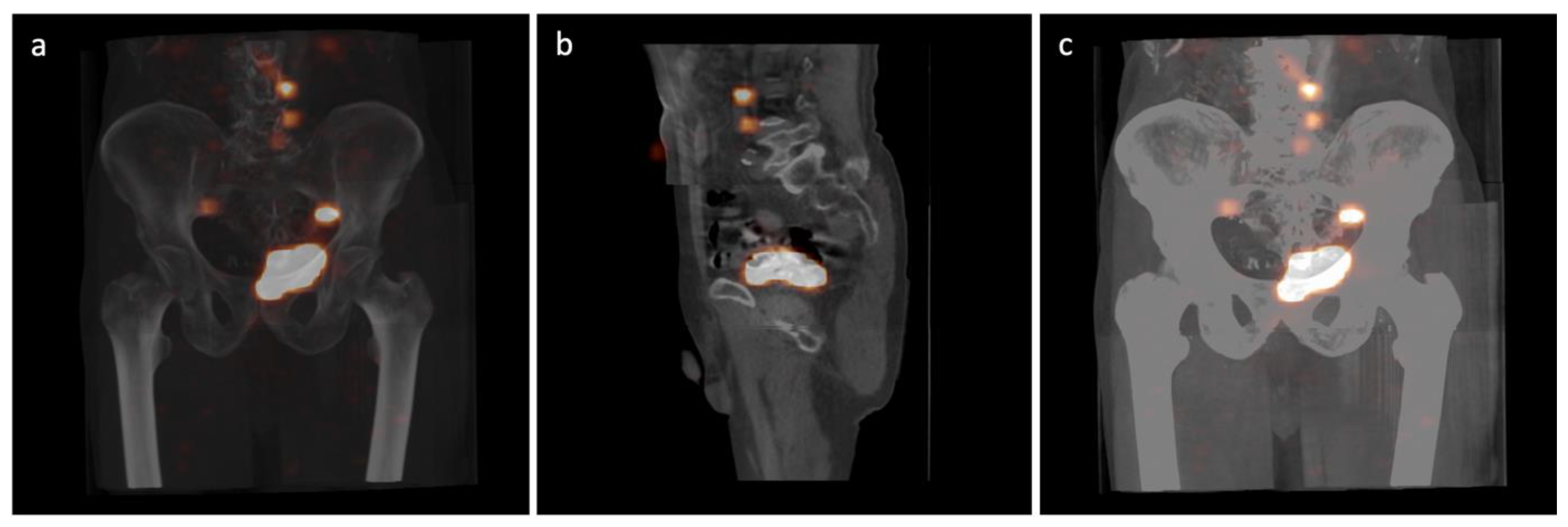 Jcm 12 03092 g001 Jcm 12 03092 g001