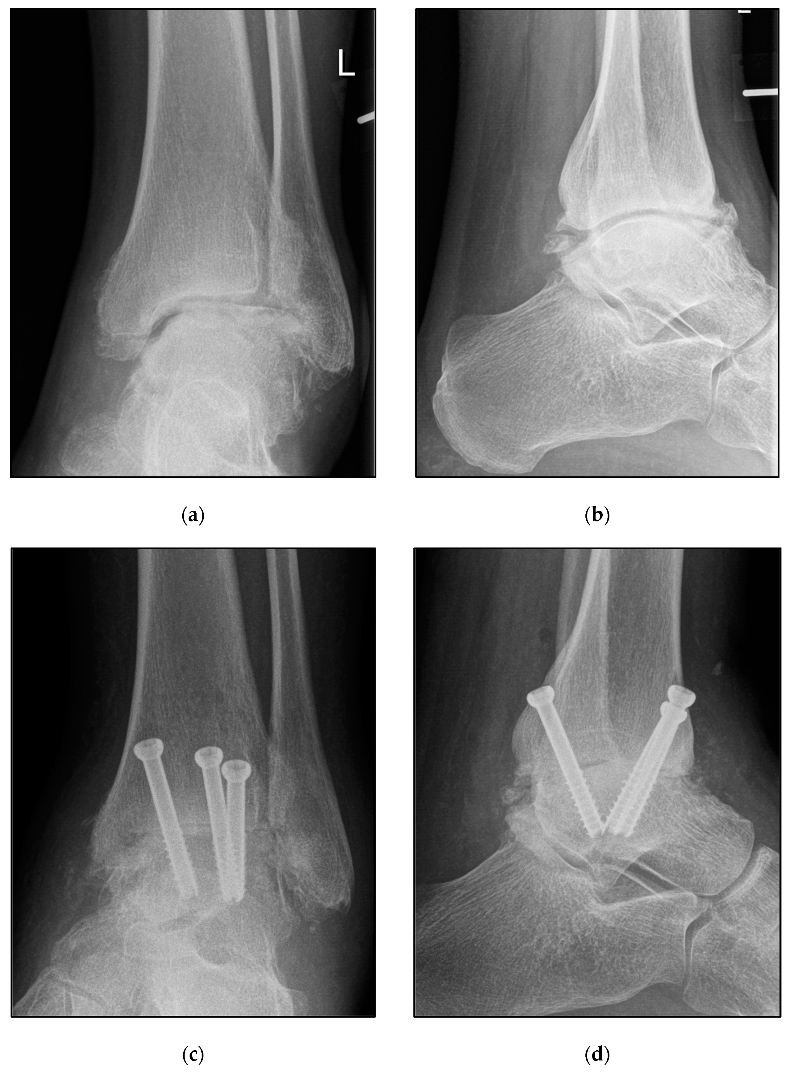 Jcm 12 03123 g003 550