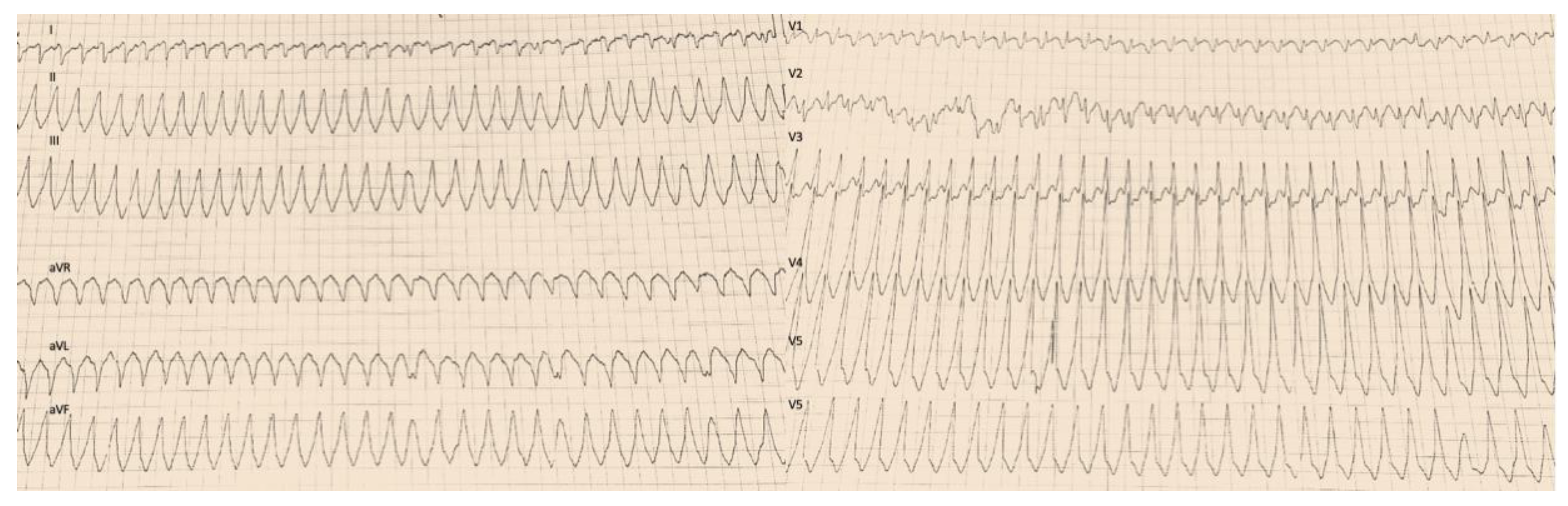 Jcm 12 03153 g003 Jcm 12 03153 g003