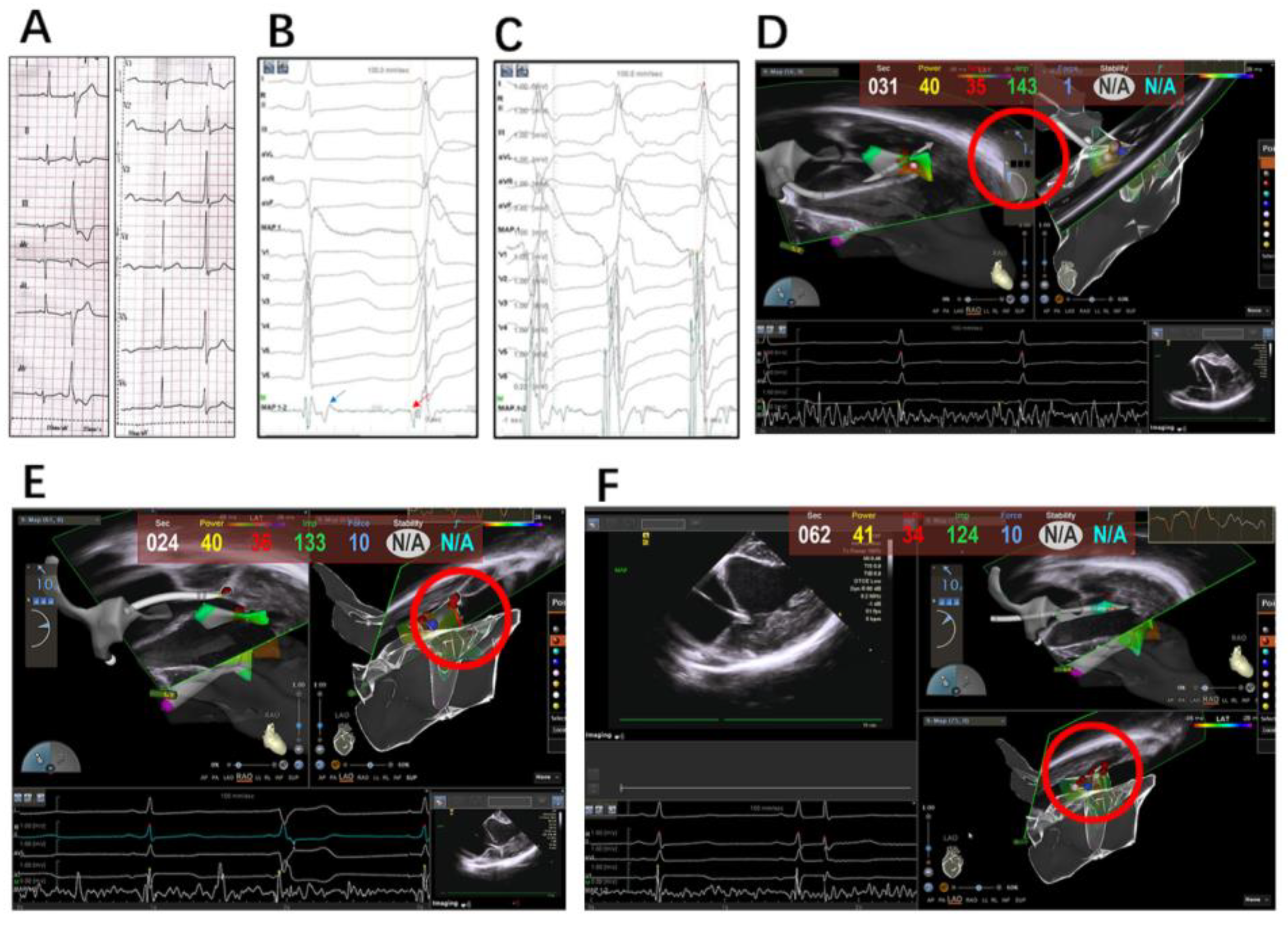 Jcm 12 03154 g003 Jcm 12 03154 g003